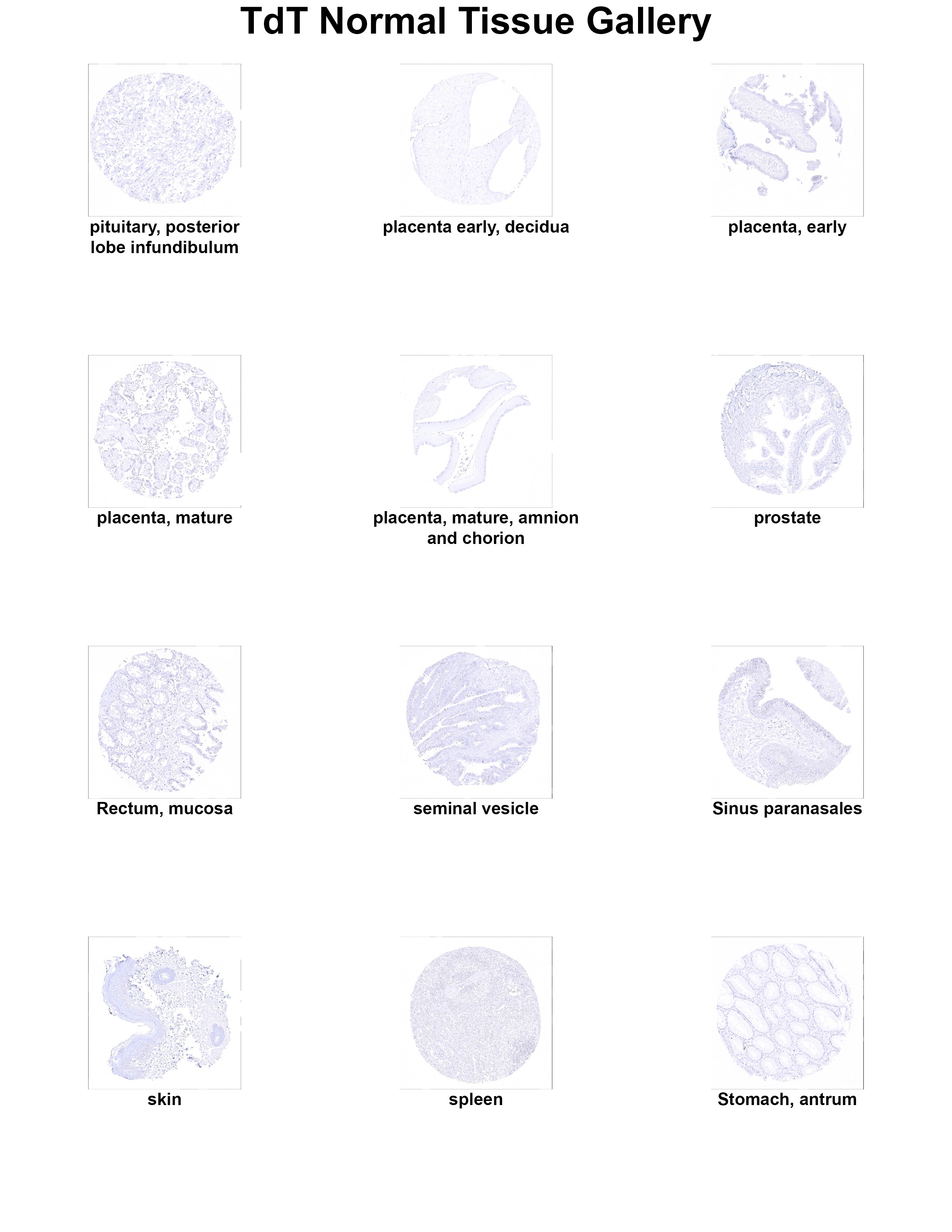 TdT Antibody (MSVA-453R) TdT Antibody (MSVA-453R) TdT Normal Tissue Gallery