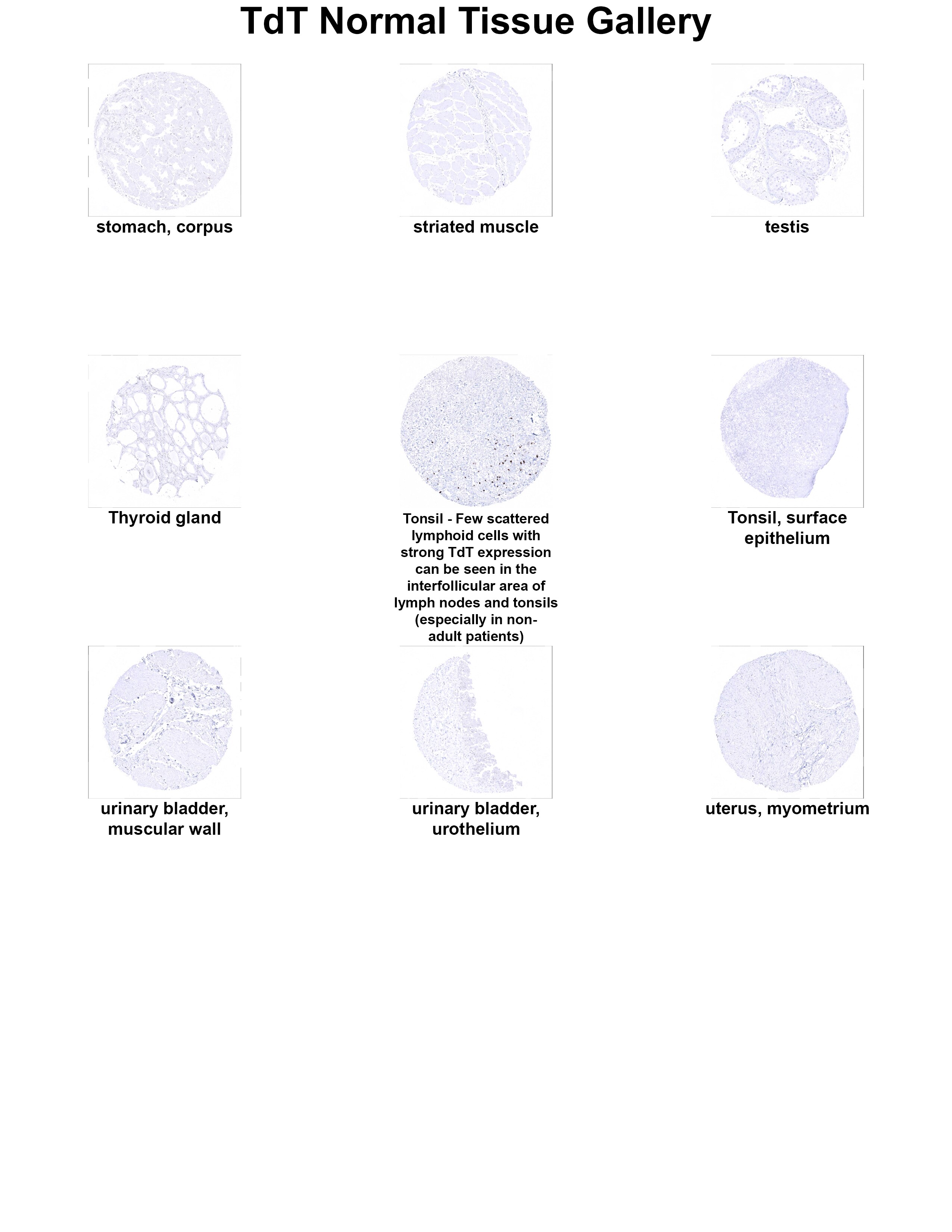 TdT Antibody (MSVA-453R) TdT Antibody (MSVA-453R) TdT Normal Tissue Gallery