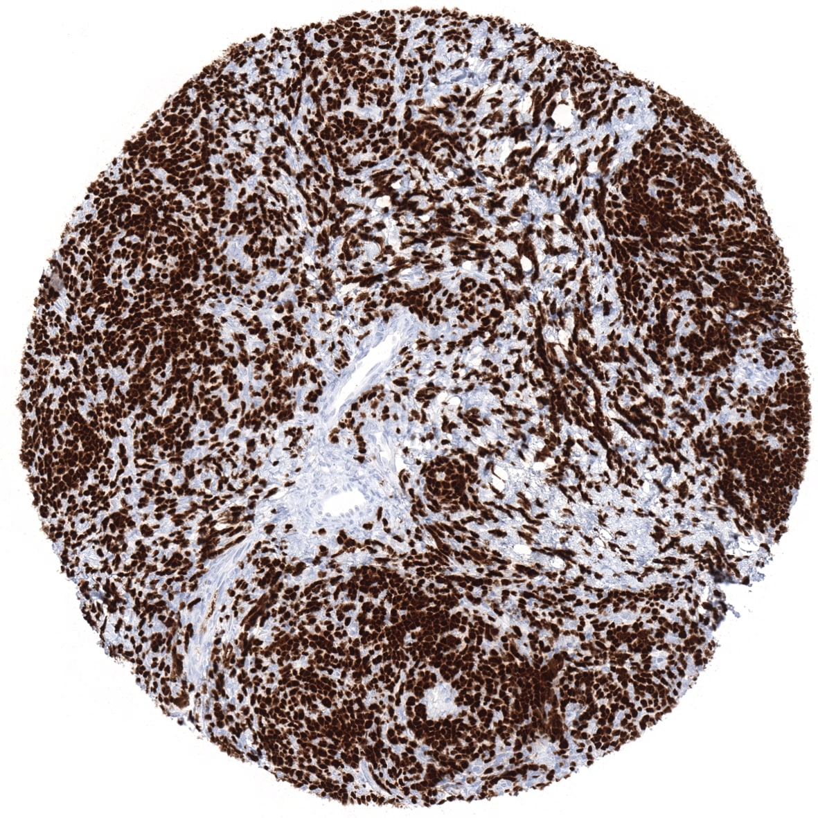TdT Antibody (MSVA-453R)