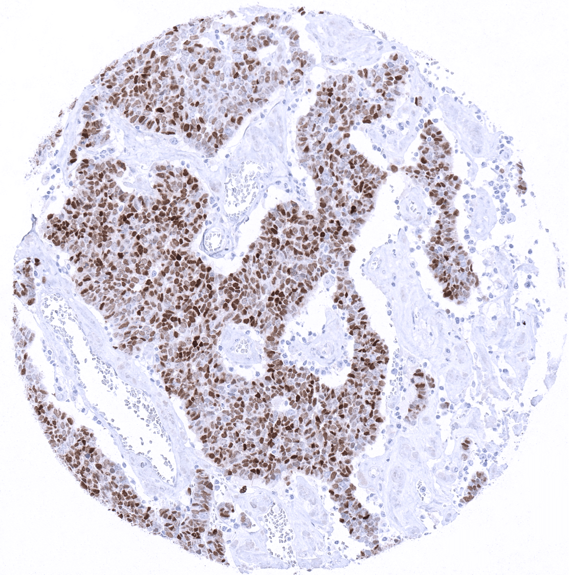 TdT Antibody (MSVA-453R)