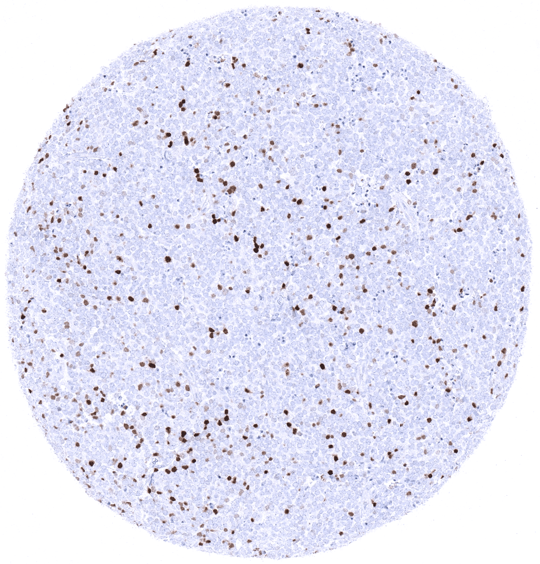 TdT Antibody (MSVA-453R)