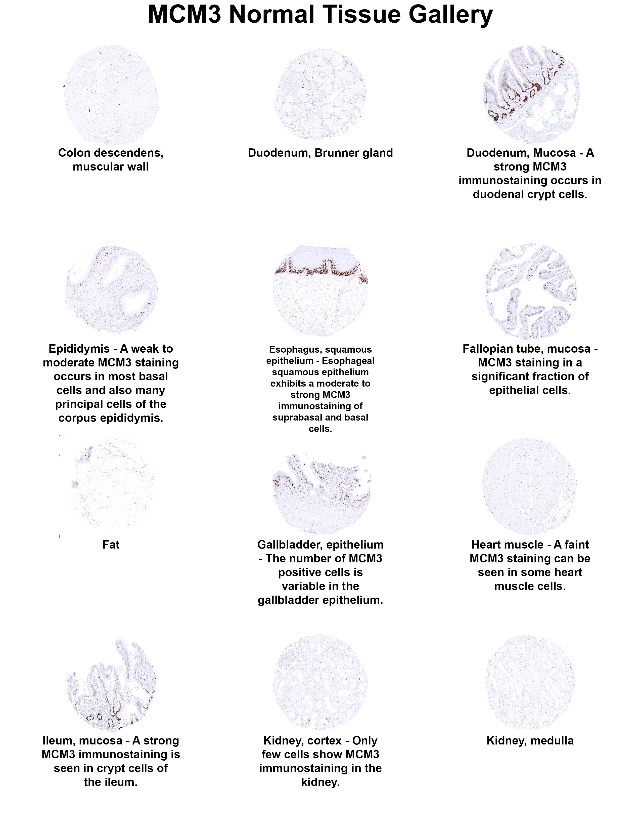 MCM3 Antibody (MSVA-503M) MCM3 Antibody (MSVA-503M) MCM3 Normal Tissue Gallery
