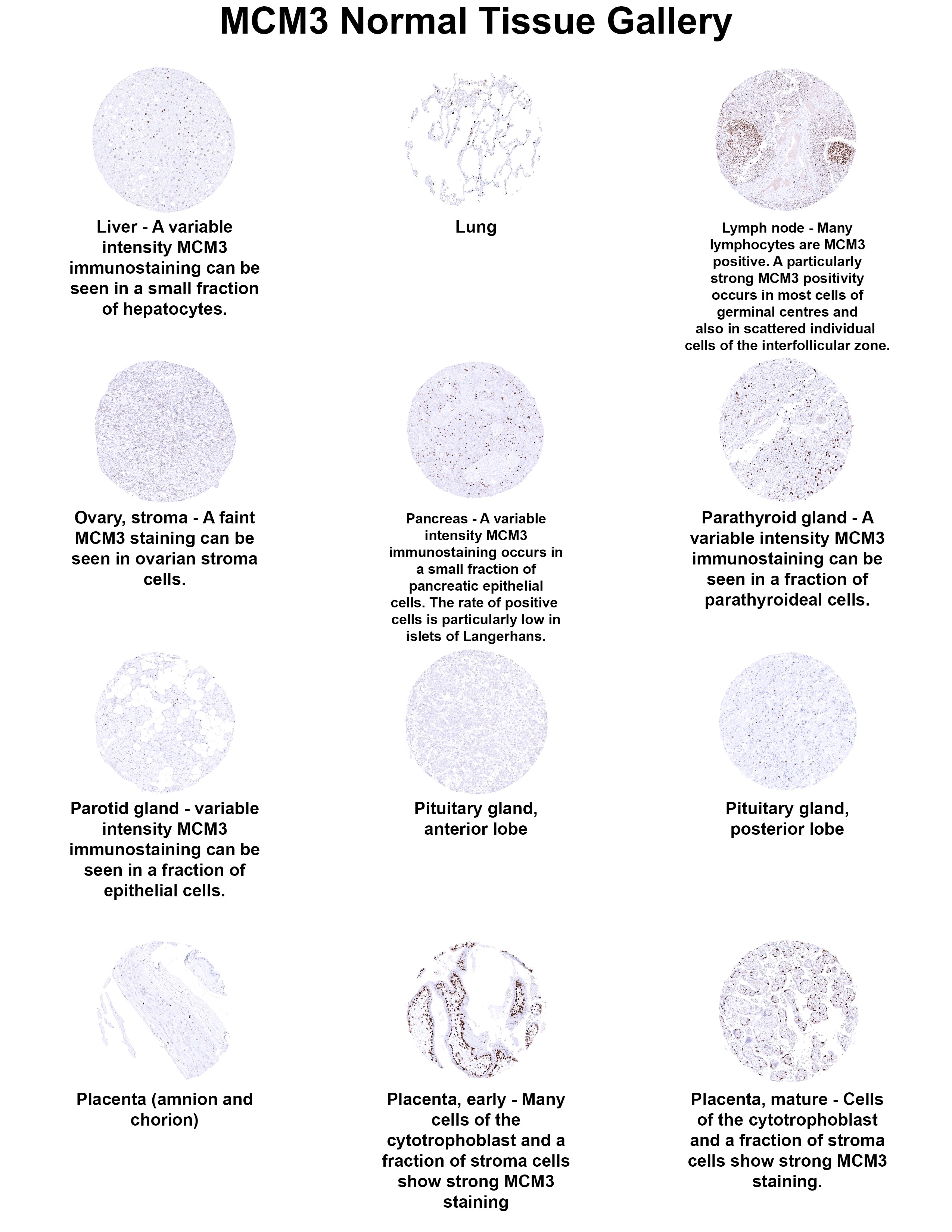 MCM3 Antibody (MSVA-503M) MCM3 Antibody (MSVA-503M) MCM3 Normal Tissue Gallery