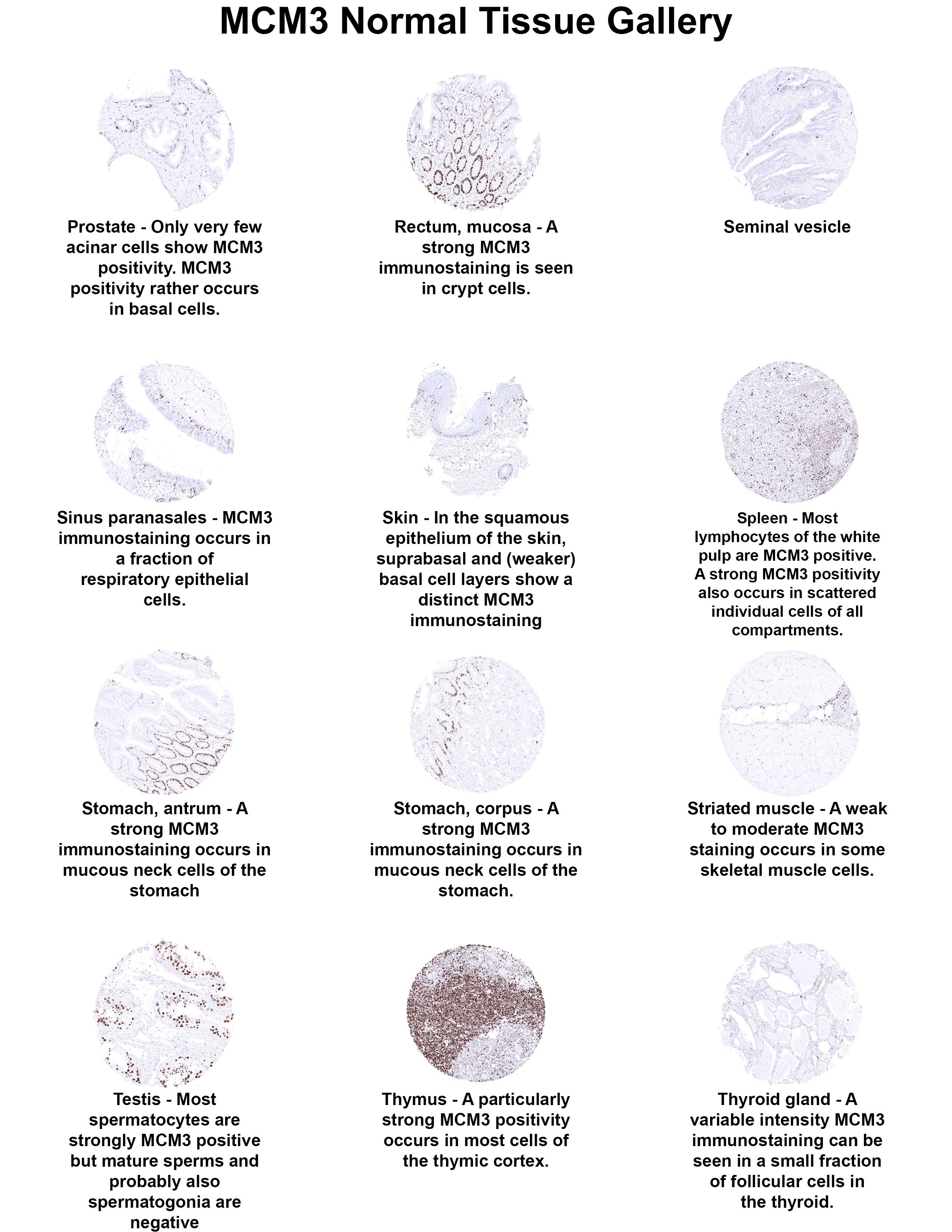 MCM3 Antibody (MSVA-503M) MCM3 Antibody (MSVA-503M) MCM3 Normal Tissue Gallery