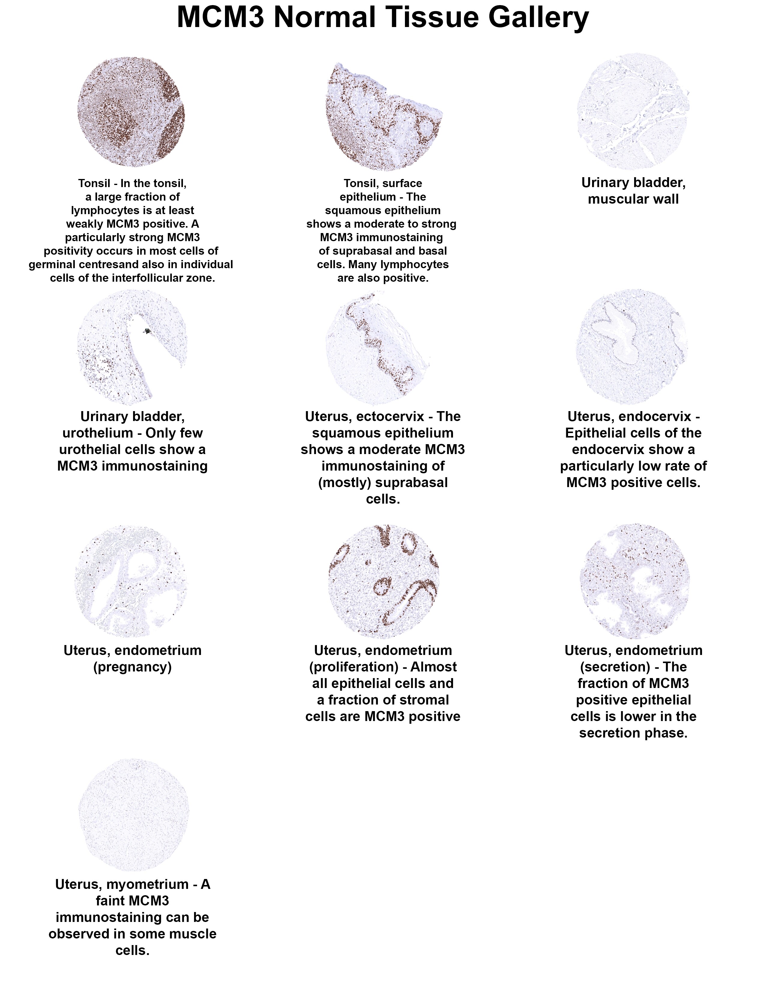 MCM3 Antibody (MSVA-503M) MCM3 Antibody (MSVA-503M) MCM3 Normal Tissue Gallery