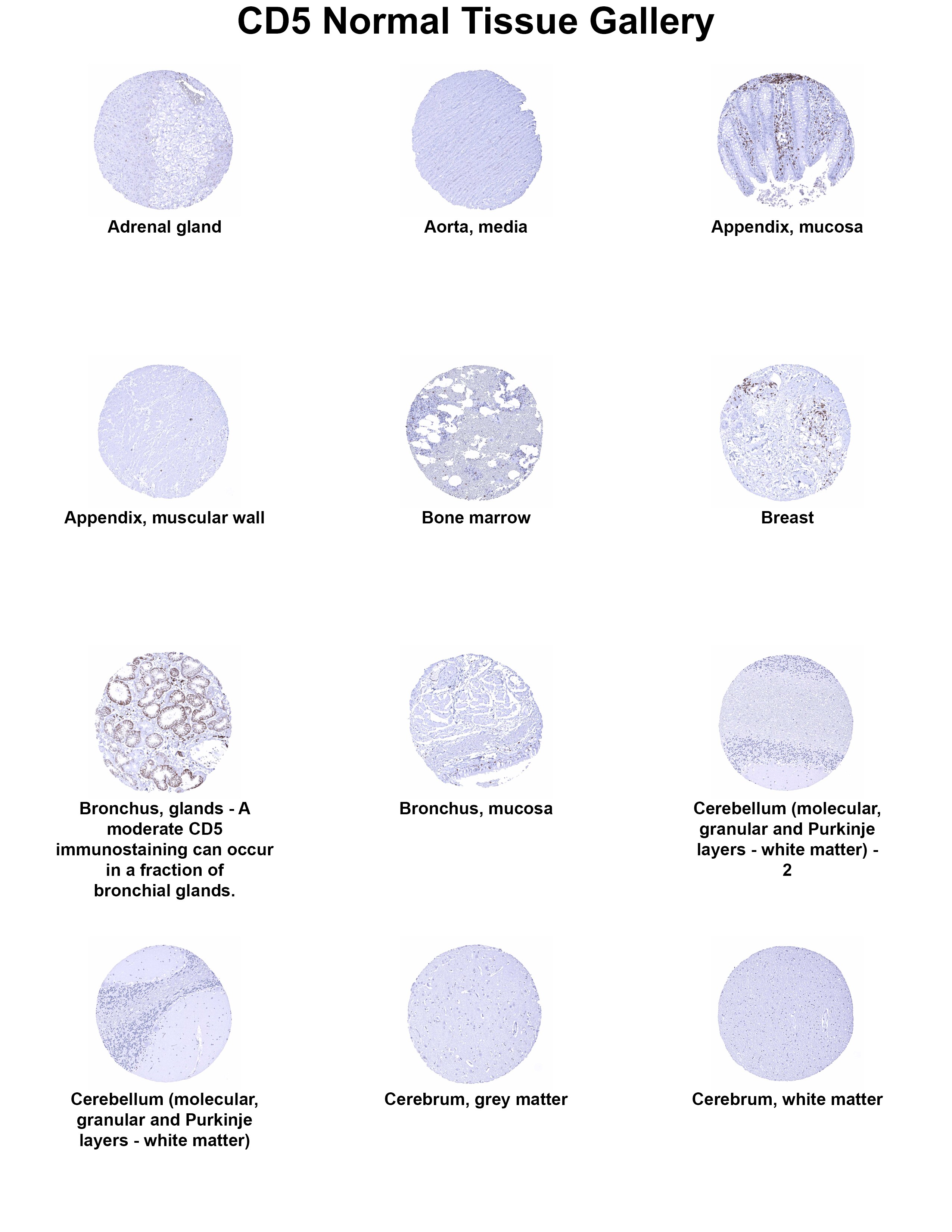 CD5 Antibody (MSVA-005R) CD5 Antibody (MSVA-005R) CD5 Normal Tissue Gallery