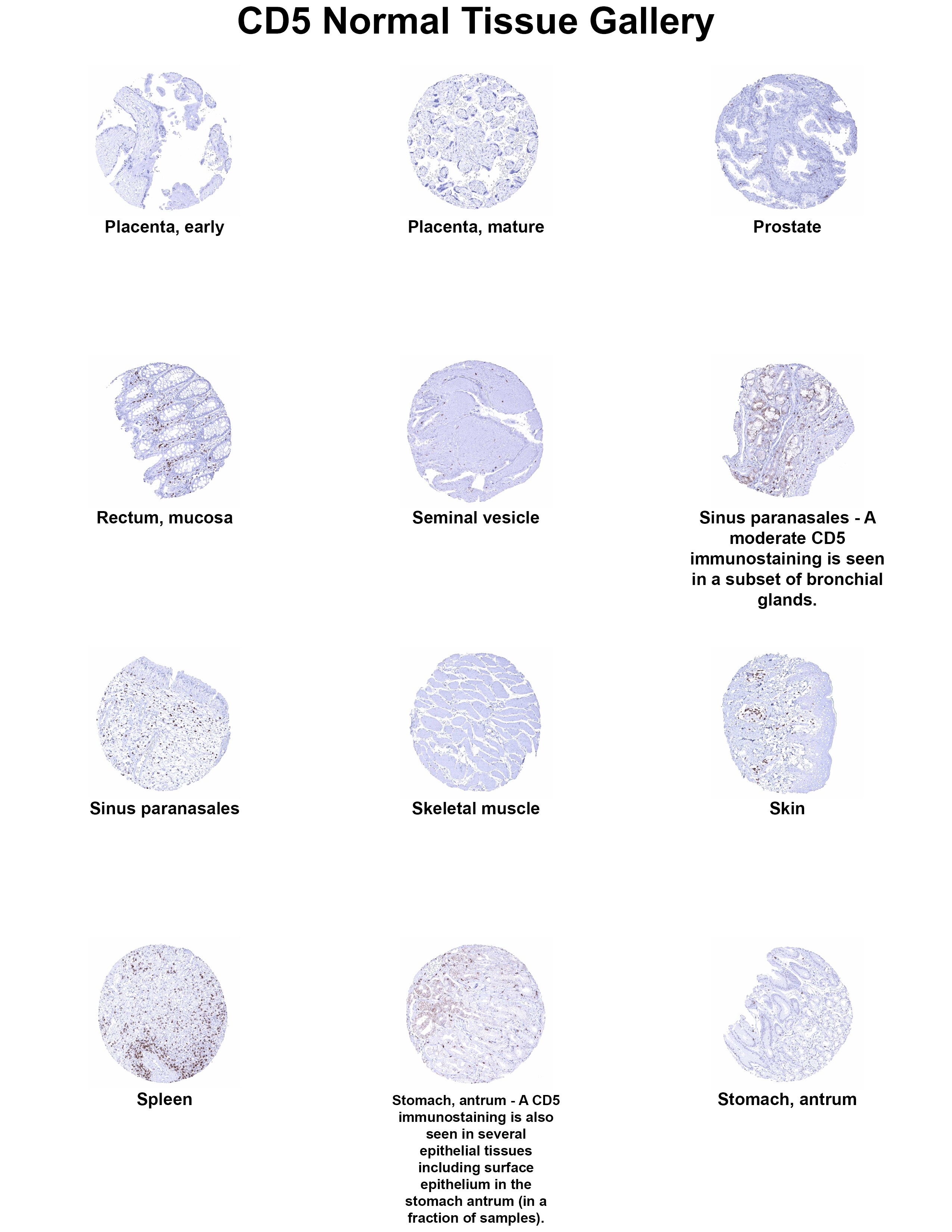 CD5 Antibody (MSVA-005R) CD5 Antibody (MSVA-005R) CD5 Normal Tissue Gallery