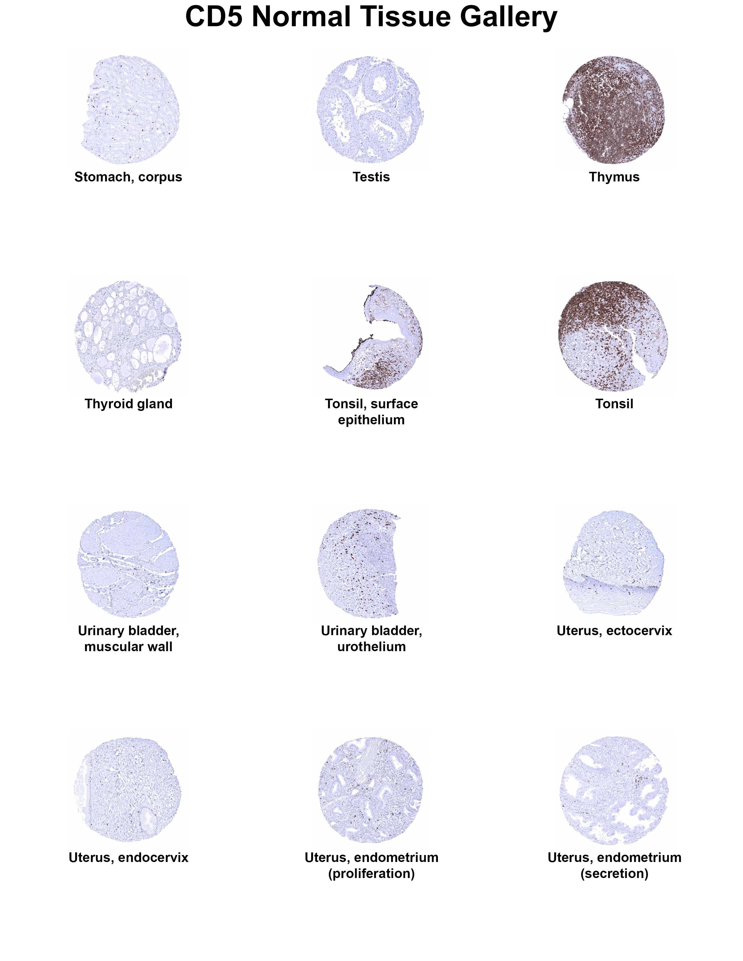 CD5 Antibody (MSVA-005R) CD5 Antibody (MSVA-005R) CD5 Normal Tissue Gallery
