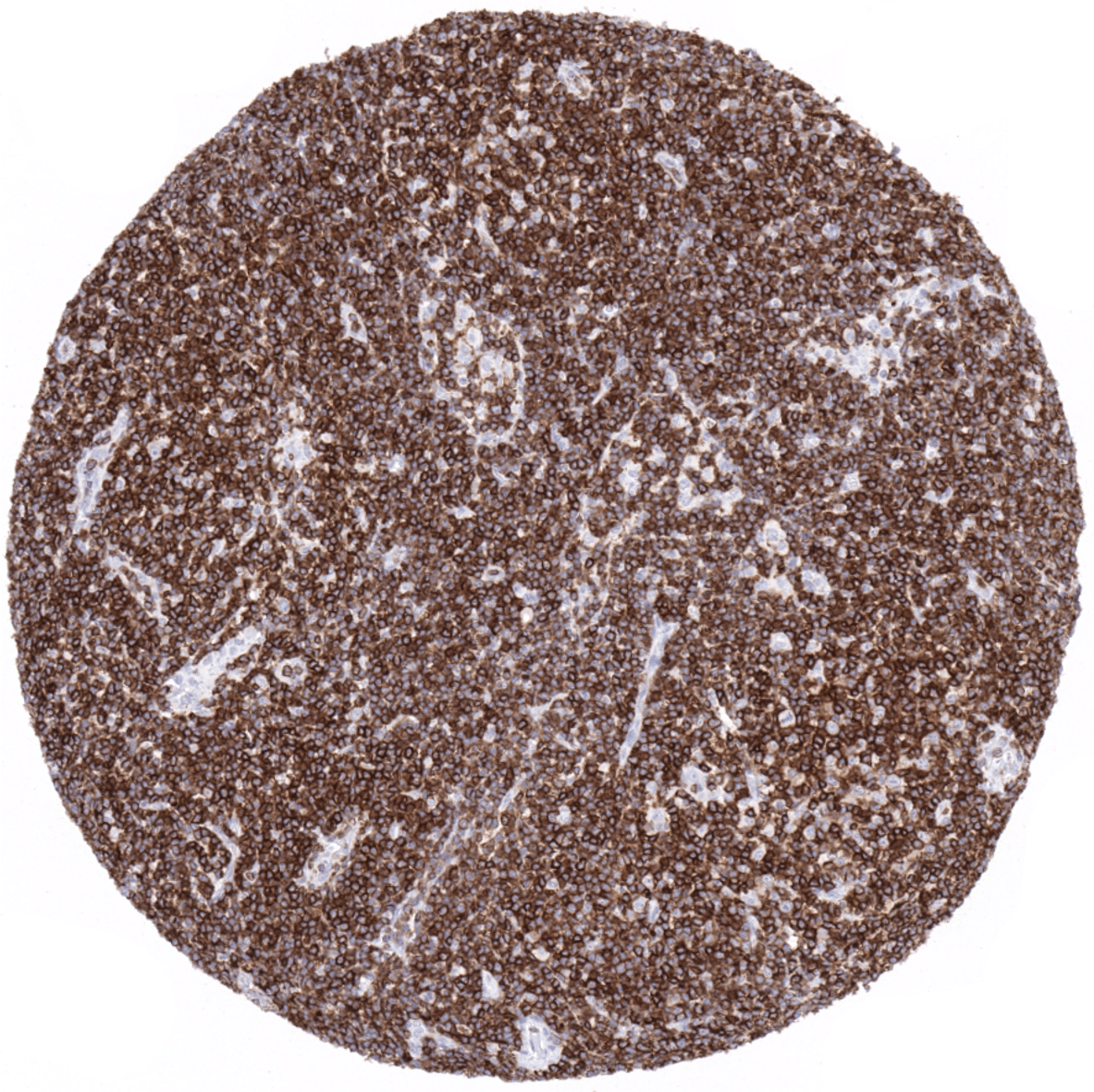 CD5 Antibody (MSVA-005R)