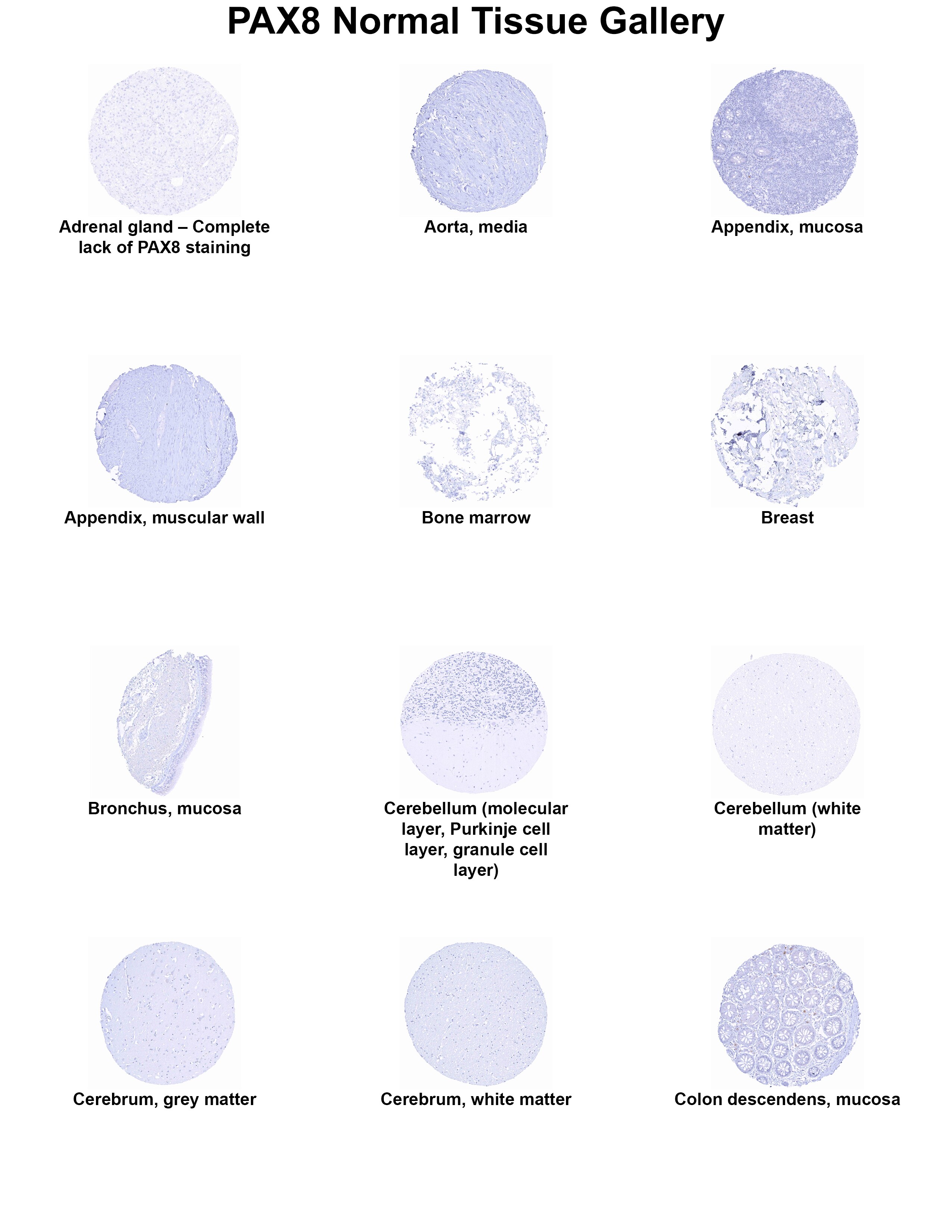 PAX8 Antibody (MSVA-708R) PAX8 Antibody (MSVA-708R) PAX8 Normal Tissue Gallery