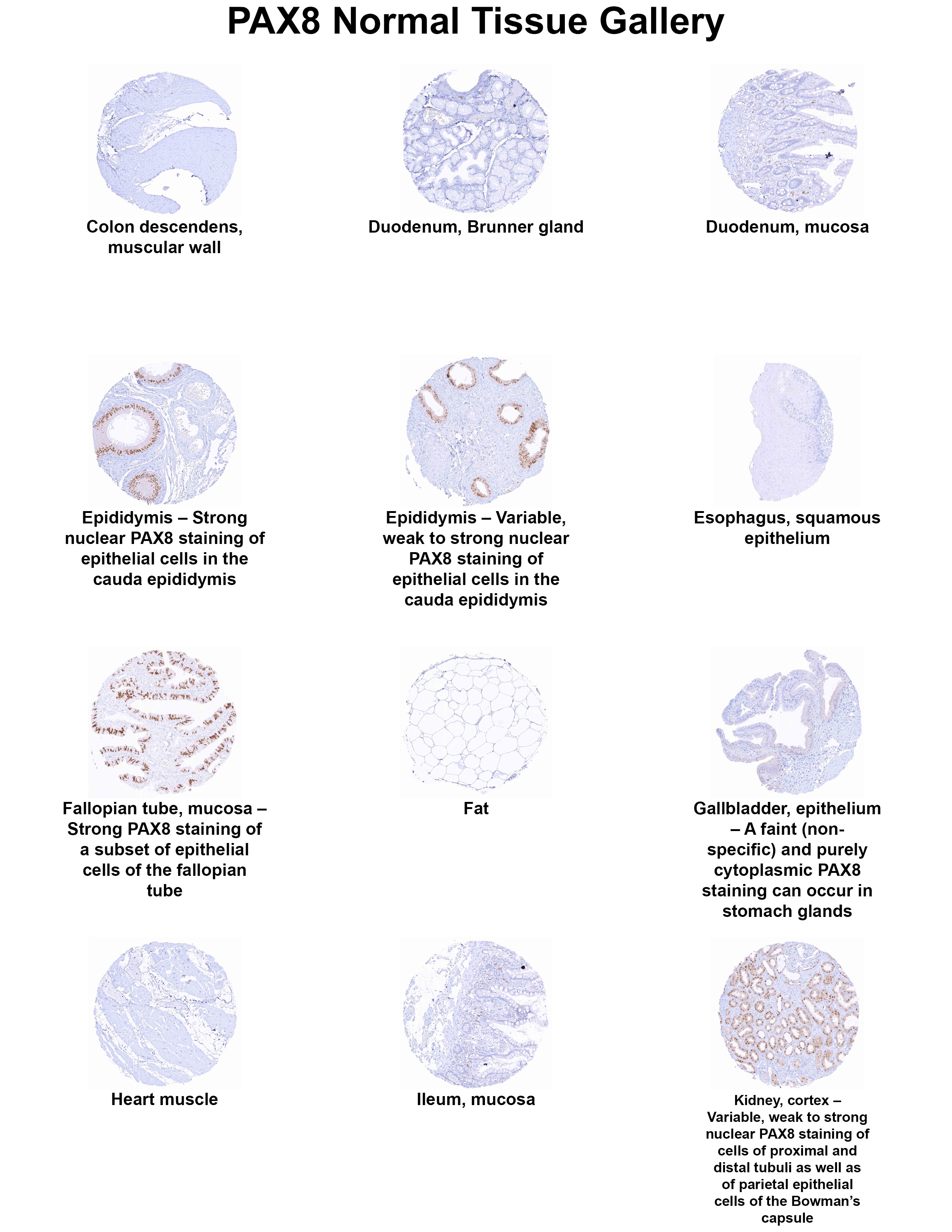 PAX8 Antibody (MSVA-708R) PAX8 Antibody (MSVA-708R) PAX8 Normal Tissue Gallery