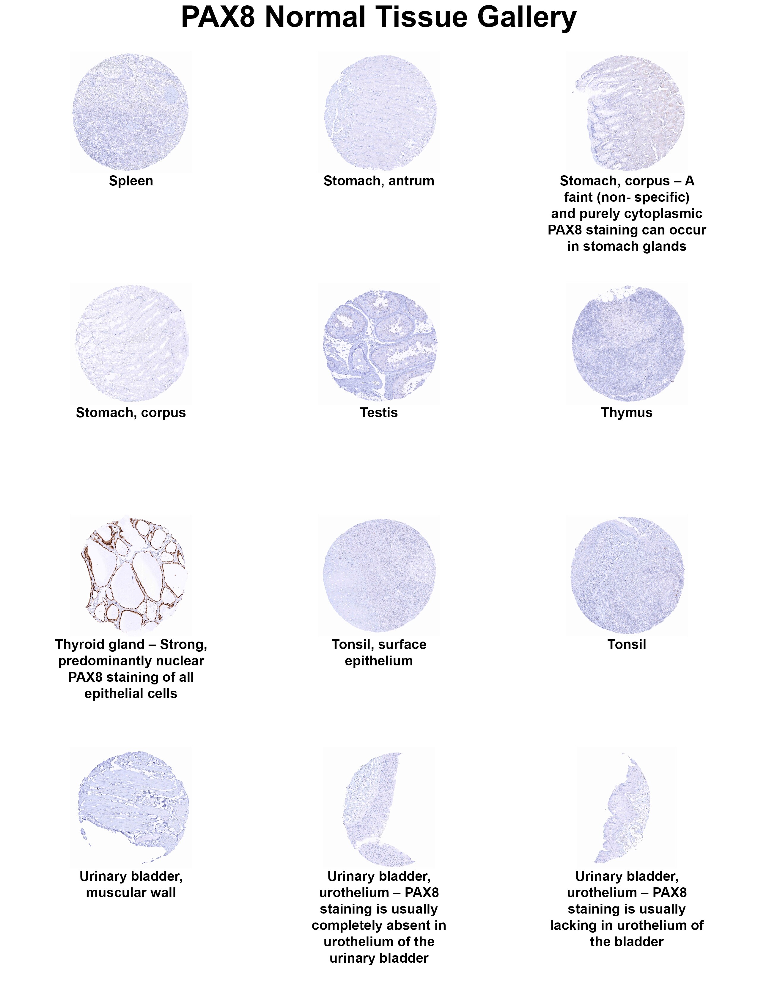 PAX8 Antibody (MSVA-708R) PAX8 Antibody (MSVA-708R) PAX8 Normal Tissue Gallery