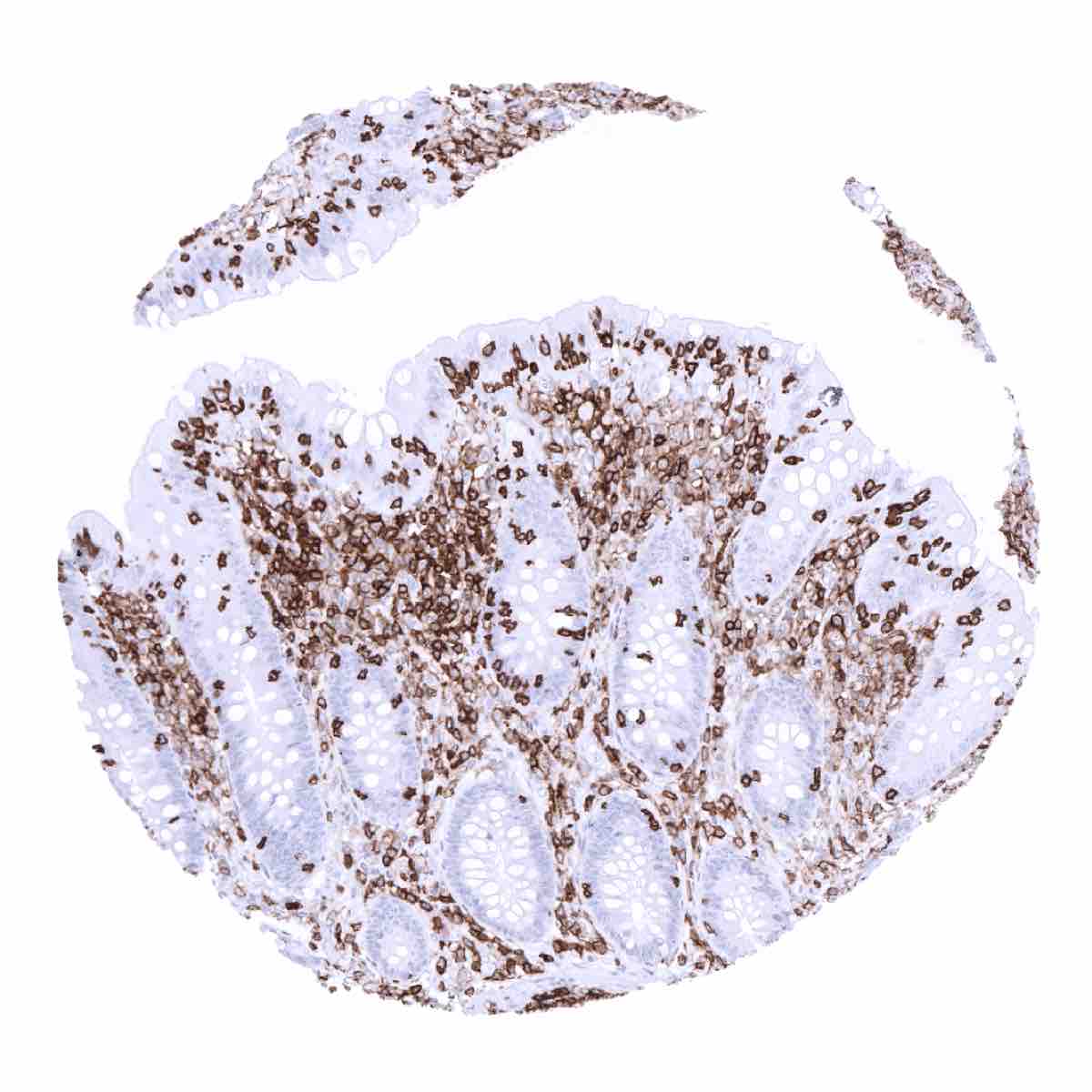 CD45 Antibody (MSVA-045R)