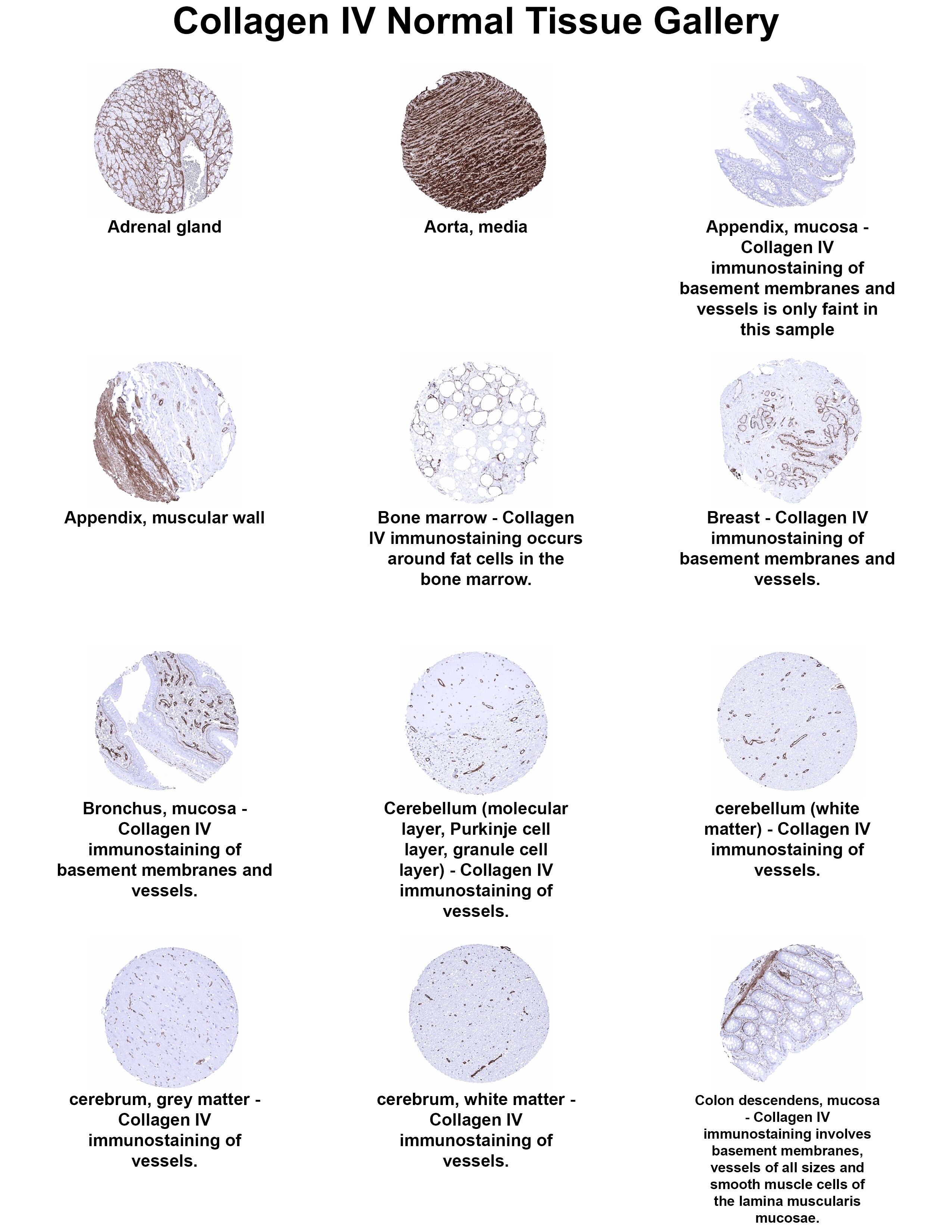 Collagen IV Antibody (MSVA-704R) Collagen IV Antibody (MSVA-704R) Collagen IV Normal Tissue Gallery