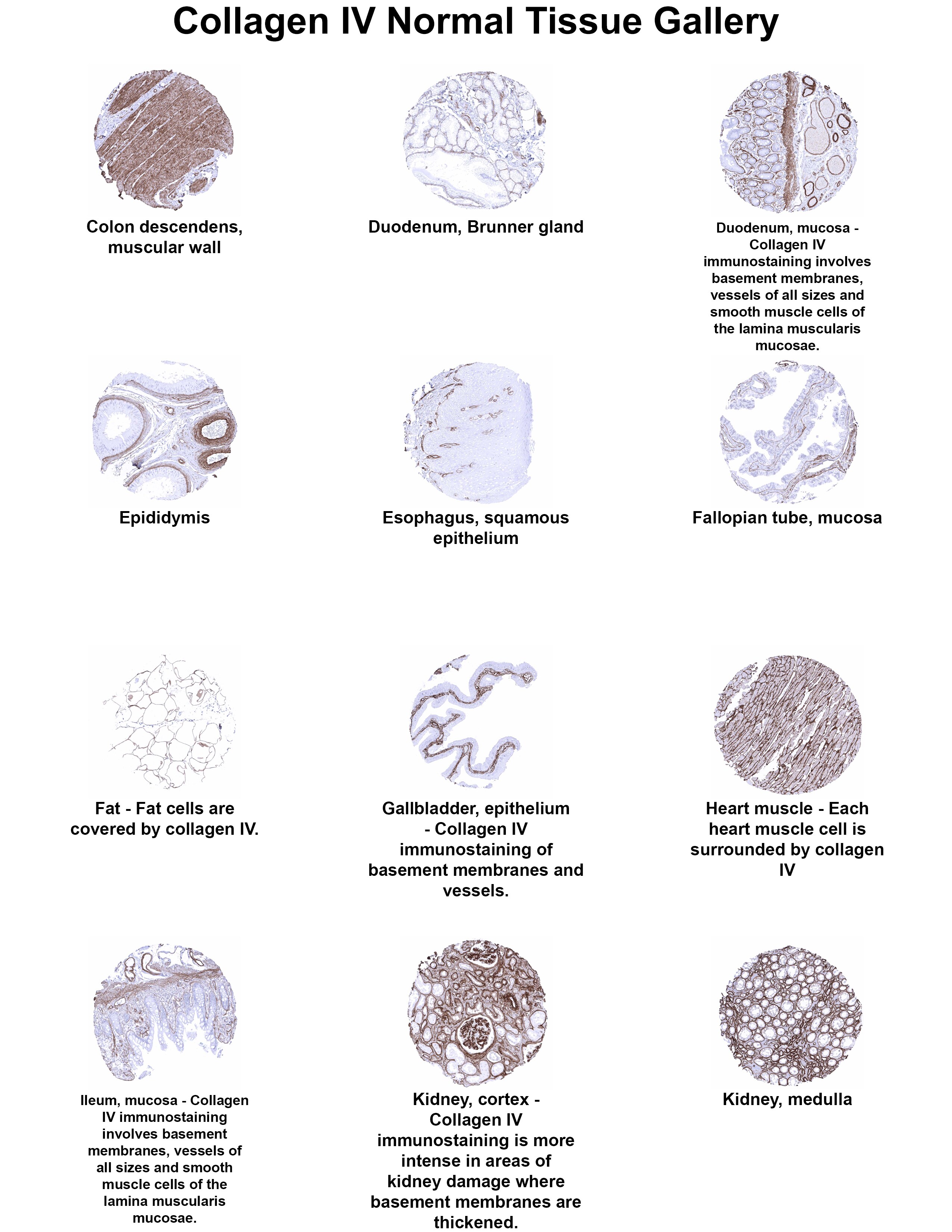 Collagen IV Antibody (MSVA-704R) Collagen IV Antibody (MSVA-704R) Collagen IV Normal Tissue Gallery