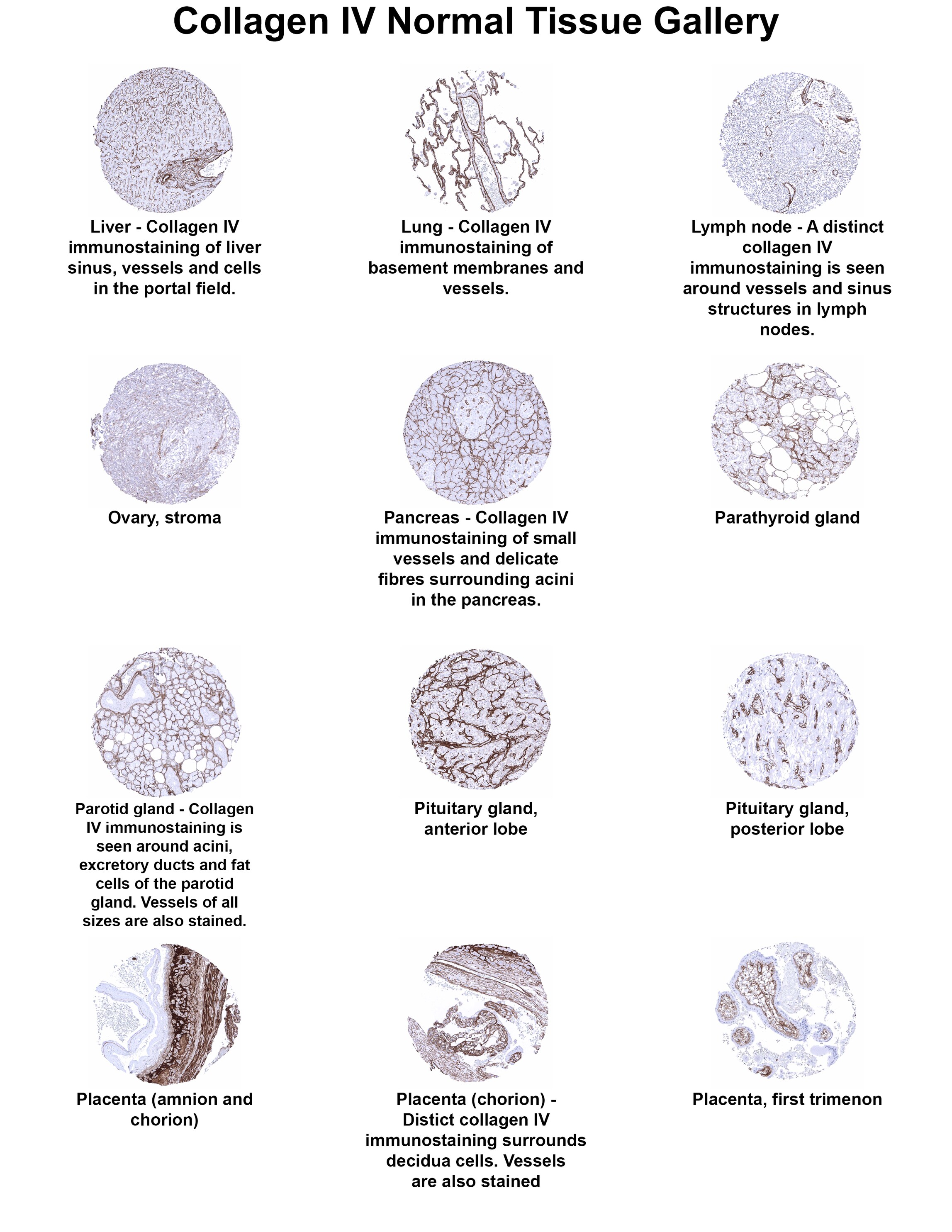 Collagen IV Antibody (MSVA-704R) Collagen IV Antibody (MSVA-704R) Collagen IV Normal Tissue Gallery
