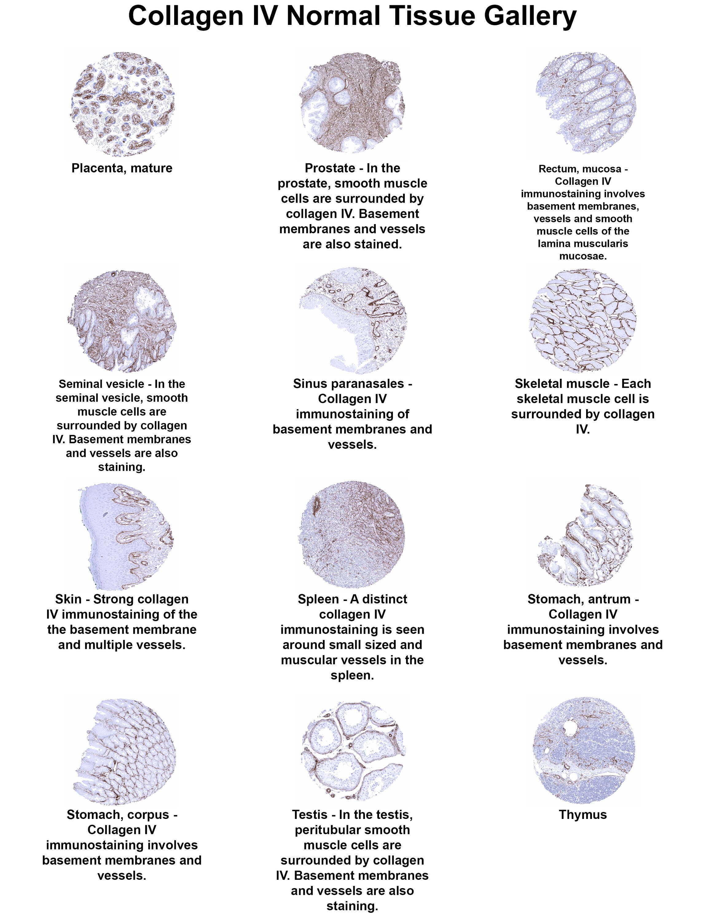 Collagen IV Antibody (MSVA-704R) Collagen IV Antibody (MSVA-704R) Collagen IV Normal Tissue Gallery