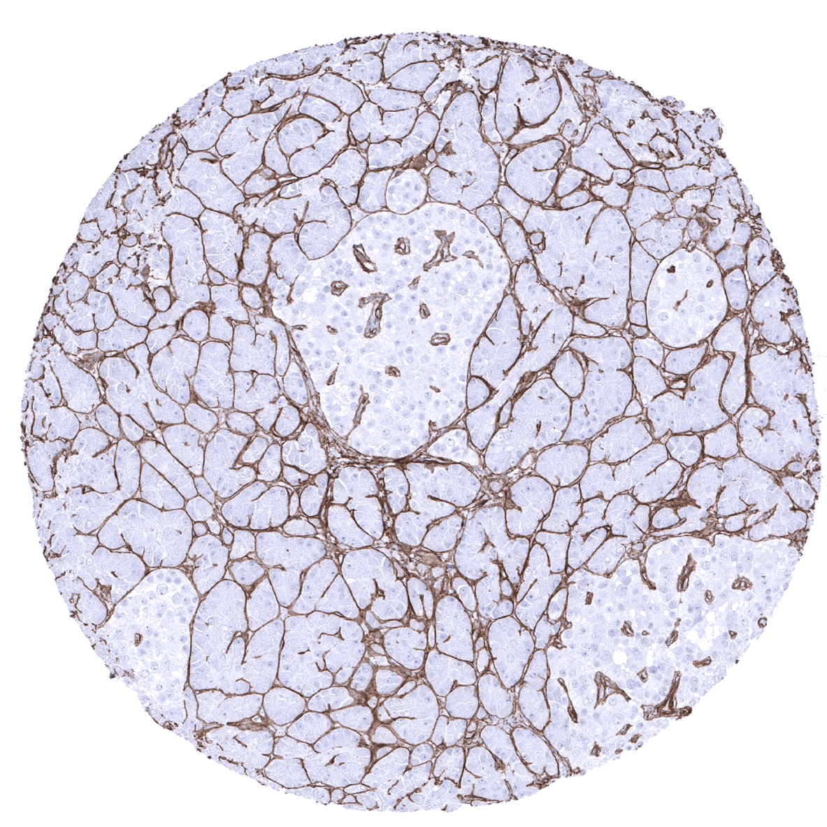 Collagen IV Antibody (MSVA-704R)