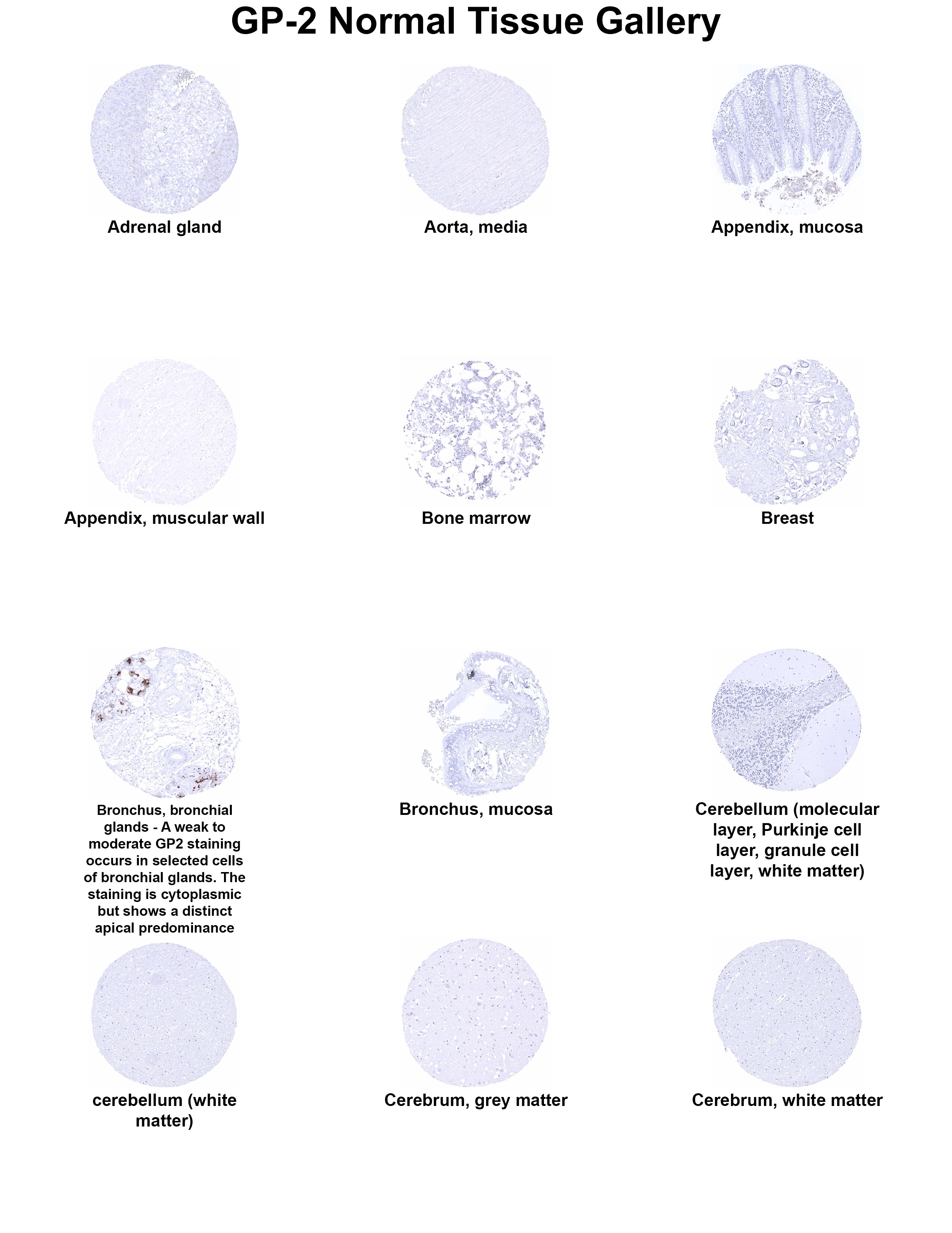GP2 Antibody (MSVA-475M) GP2 Antibody (MSVA-475M) GP2 Normal Tissue Gallery