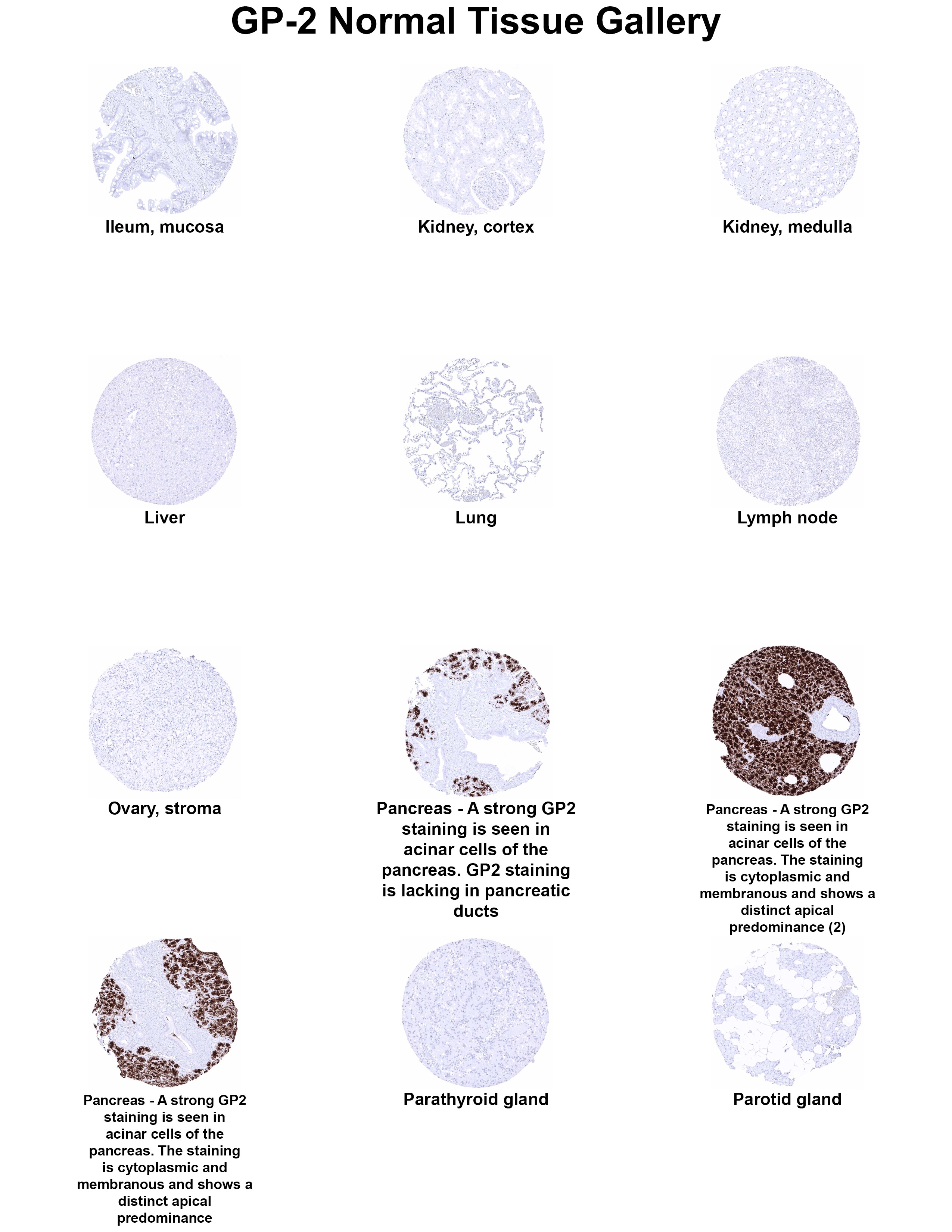 GP2 Antibody (MSVA-475M) GP2 Antibody (MSVA-475M) GP2 Normal Tissue Gallery