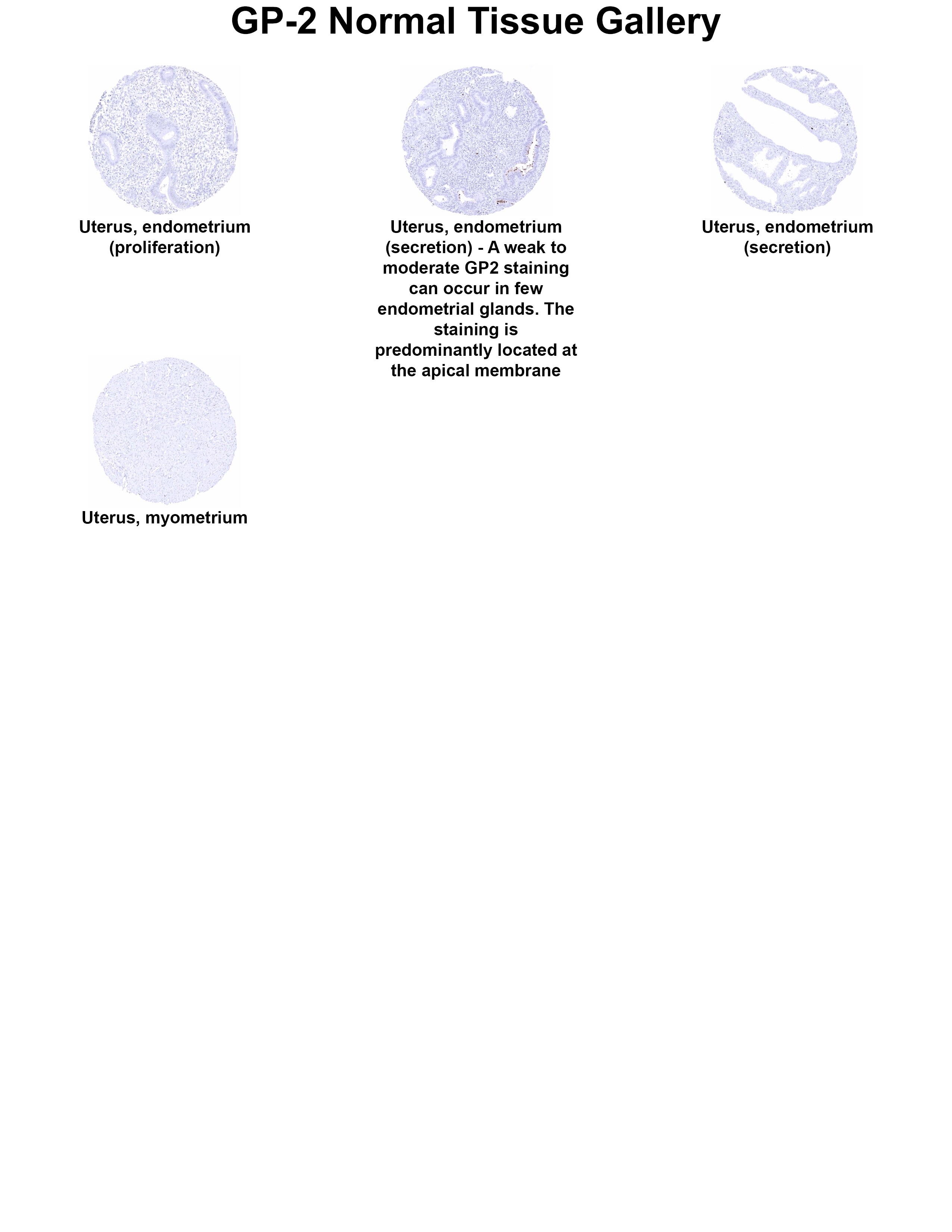 GP2 Antibody (MSVA-475M) GP2 Antibody (MSVA-475M) GP2 Normal Tissue Gallery