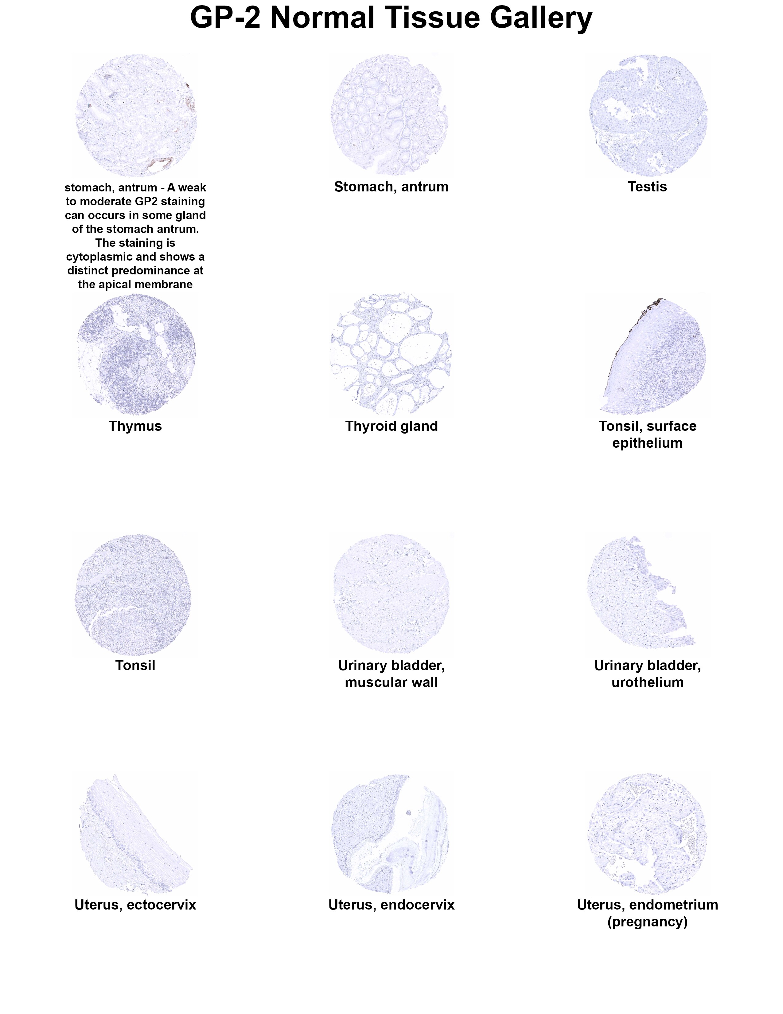 GP2 Antibody (MSVA-475M) GP2 Antibody (MSVA-475M) GP2 Normal Tissue Gallery
