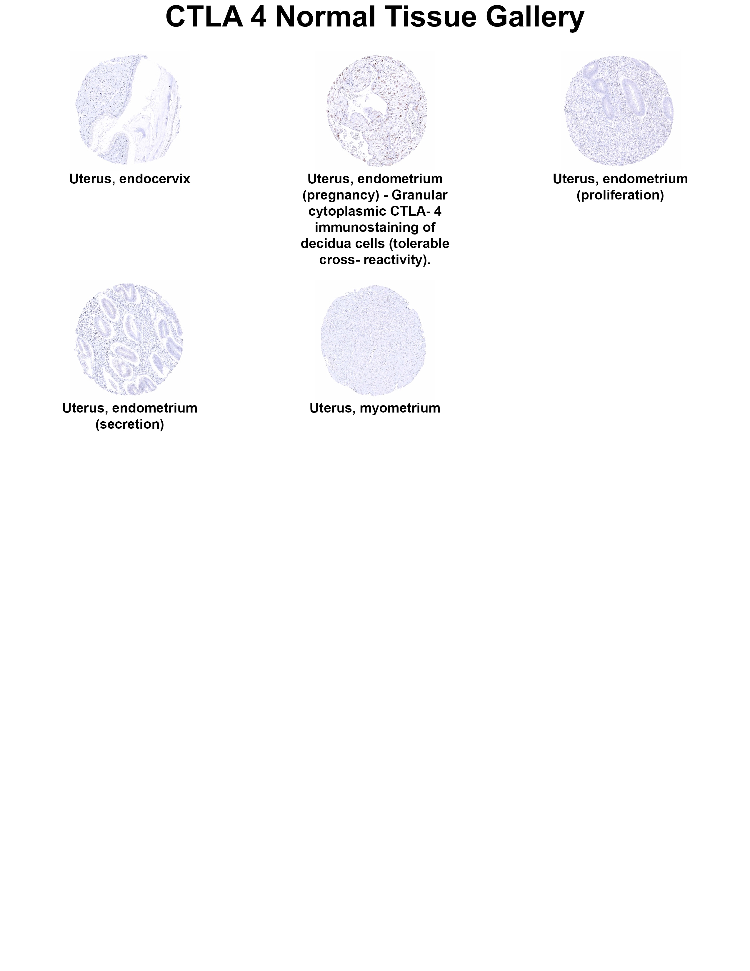 CTLA-4 Antibody (MSVA-152R) CTLA-4 Antibody (MSVA-152R) CTLA-4 Normal Tissue Gallery