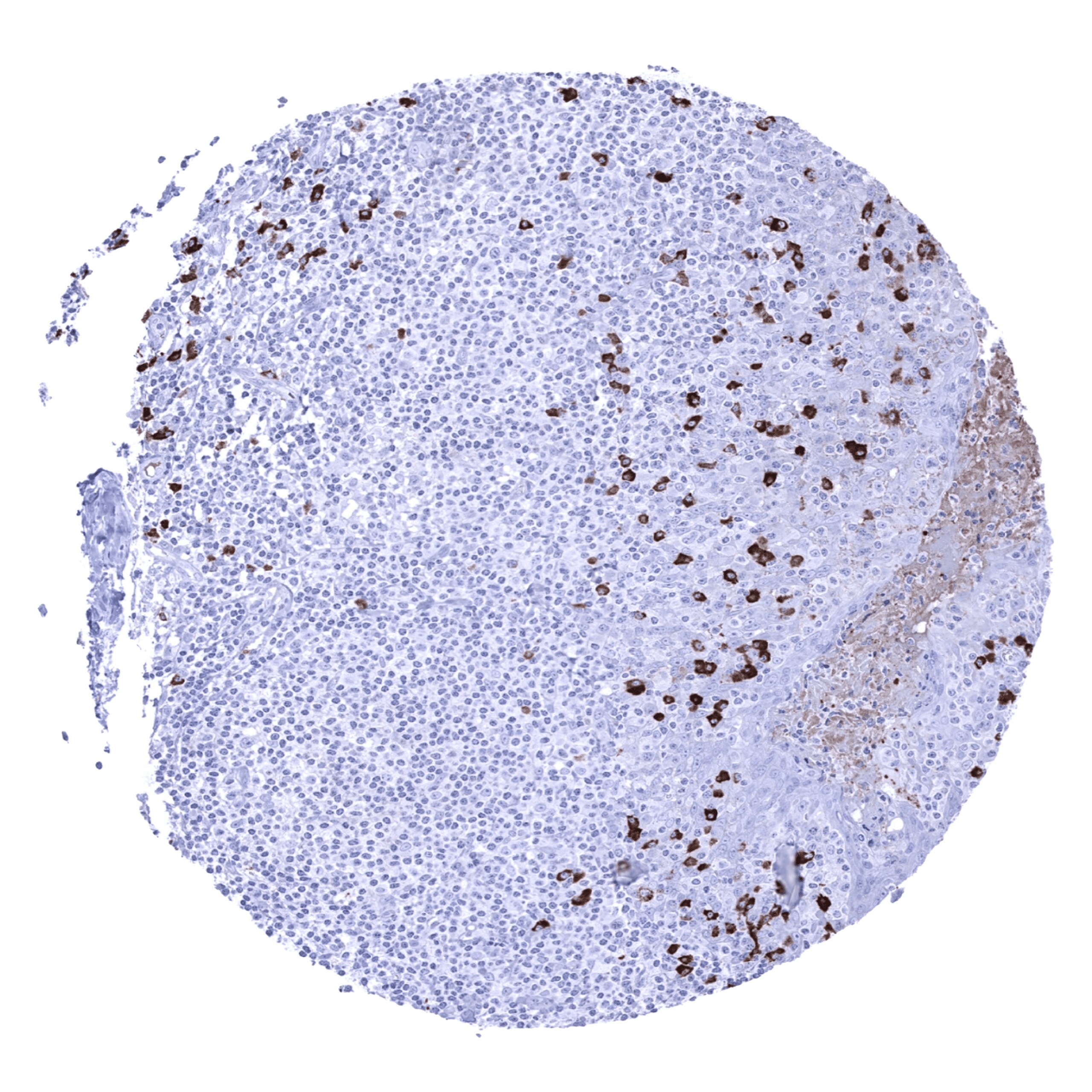 IgA Antibody (MSVA-700R)