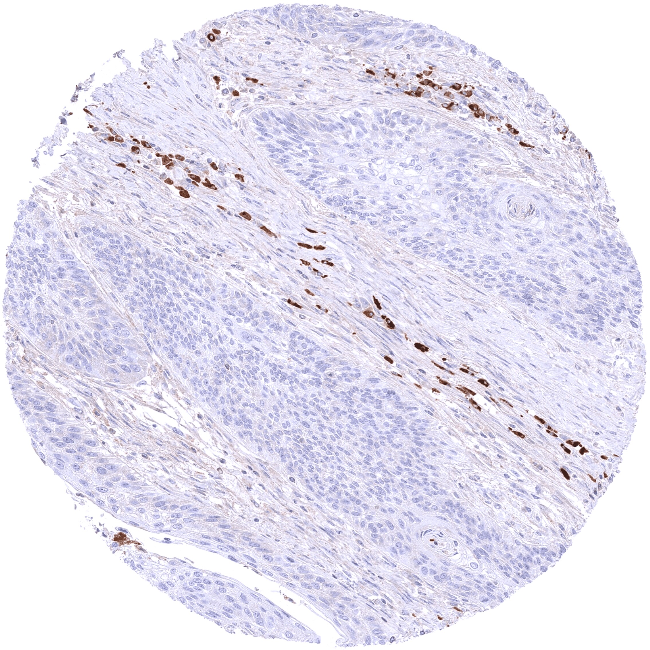 IgA Antibody (MSVA-700R)