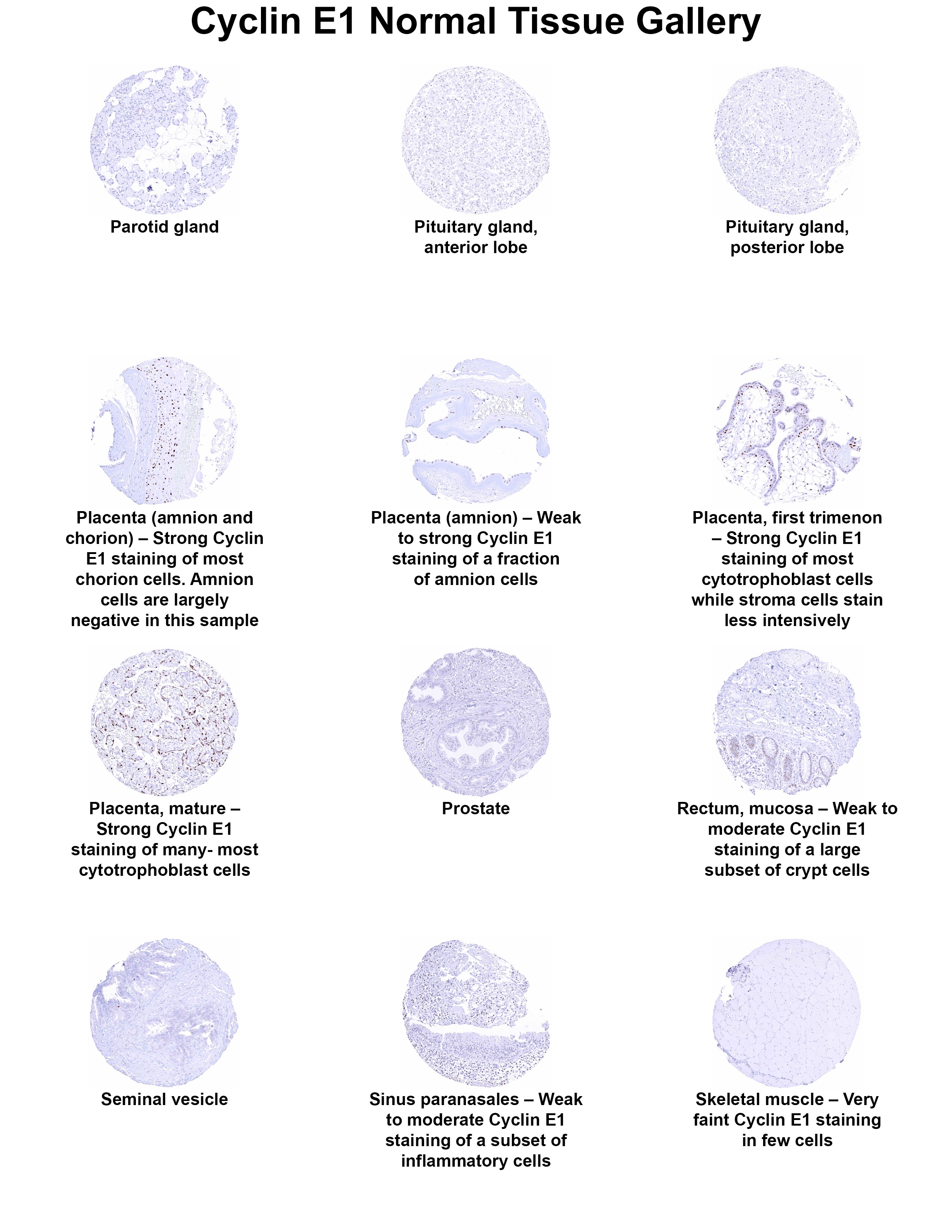 Cyclin E1 Antibody (MSVA-898R) Cyclin E1 Antibody (MSVA-898R) Cyclin E1 Normal Tissue Gallery