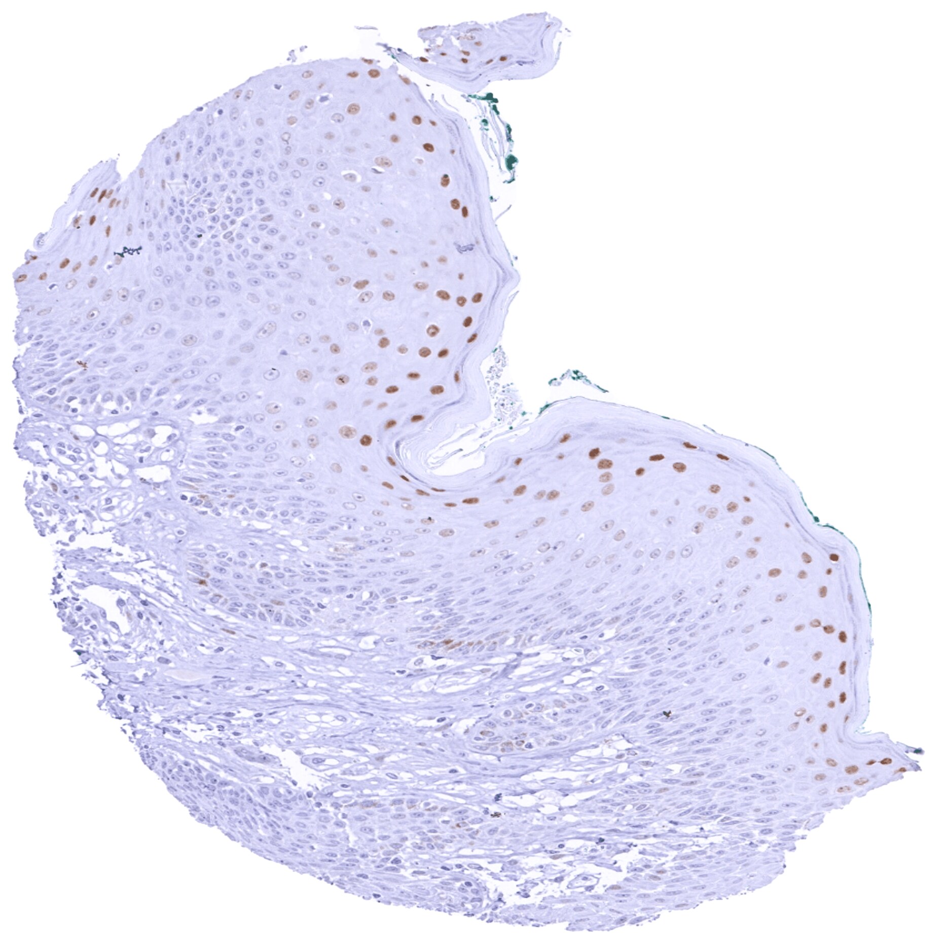 Cyclin E1 Antibody (MSVA-898R)