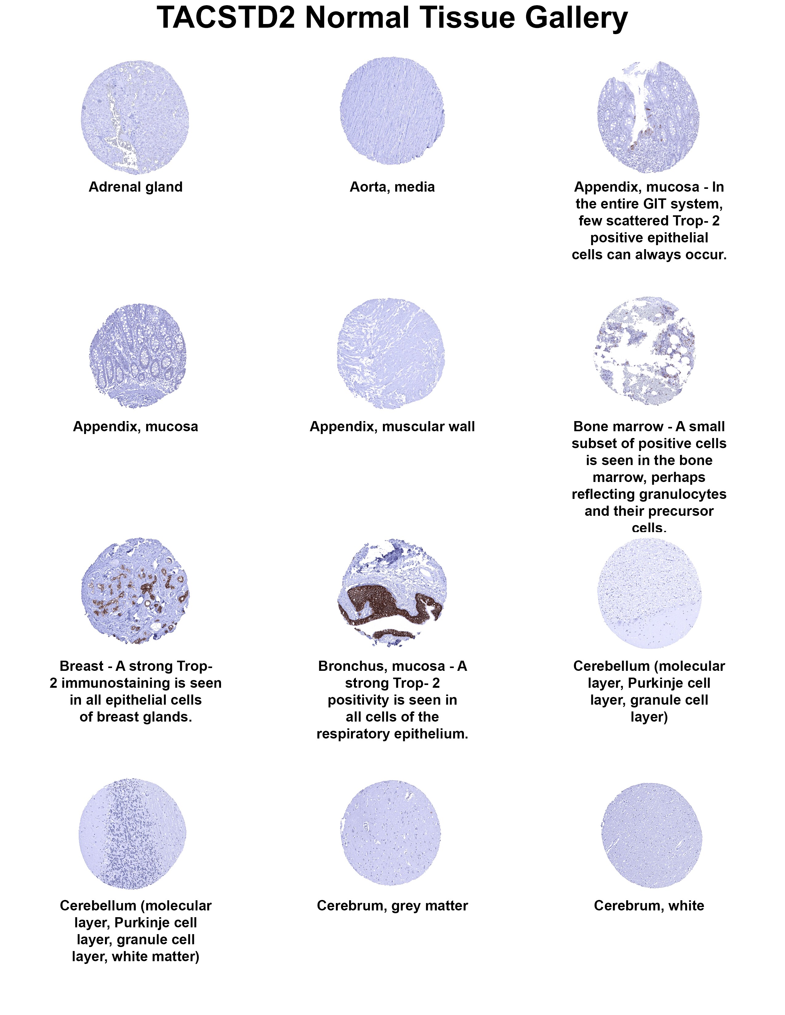 TROP-2 Antibody (MSVA-733R) TROP-2 Antibody (MSVA-733R) TROP-2 Normal Tissue Gallery