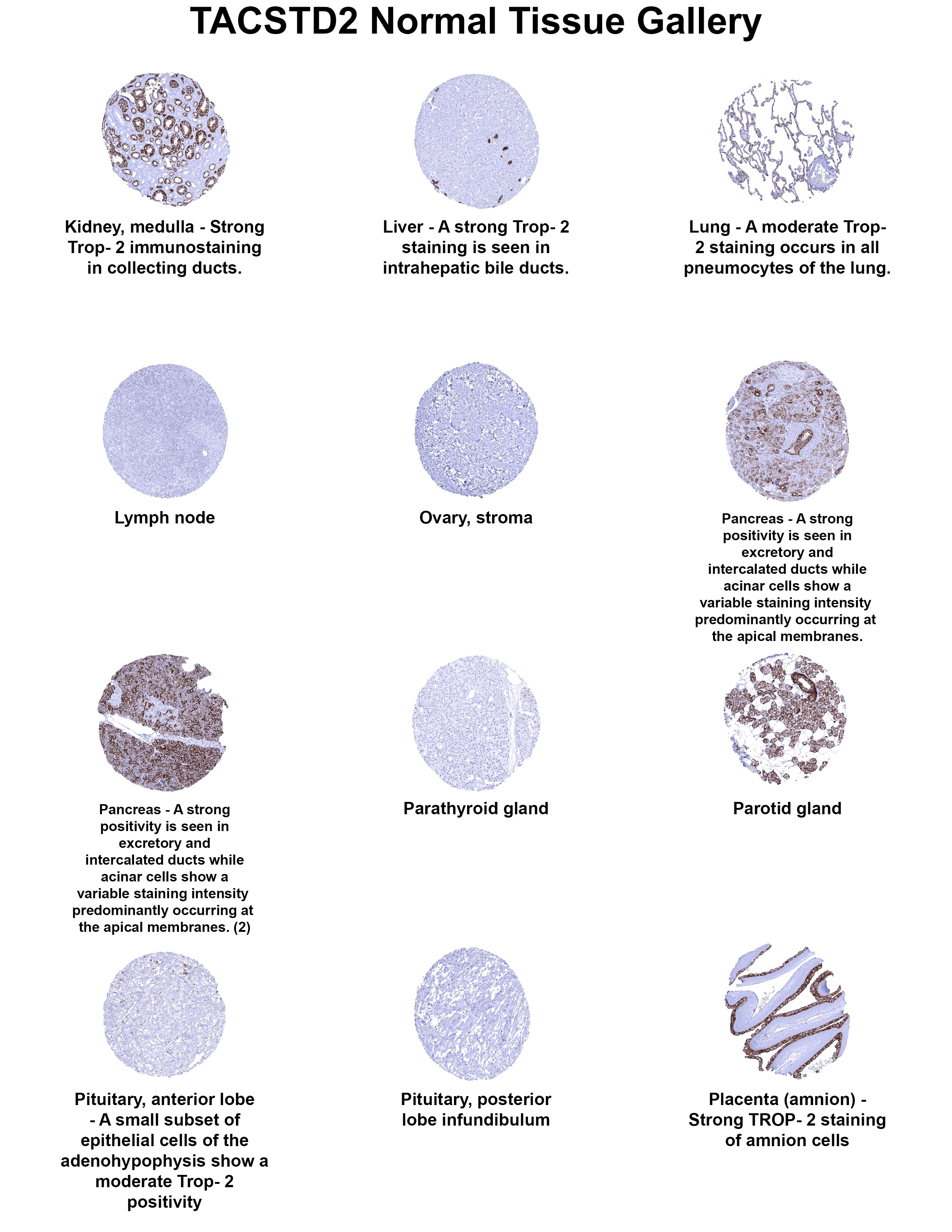 TROP-2 Antibody (MSVA-733R) TROP-2 Antibody (MSVA-733R) TROP-2 Normal Tissue Gallery