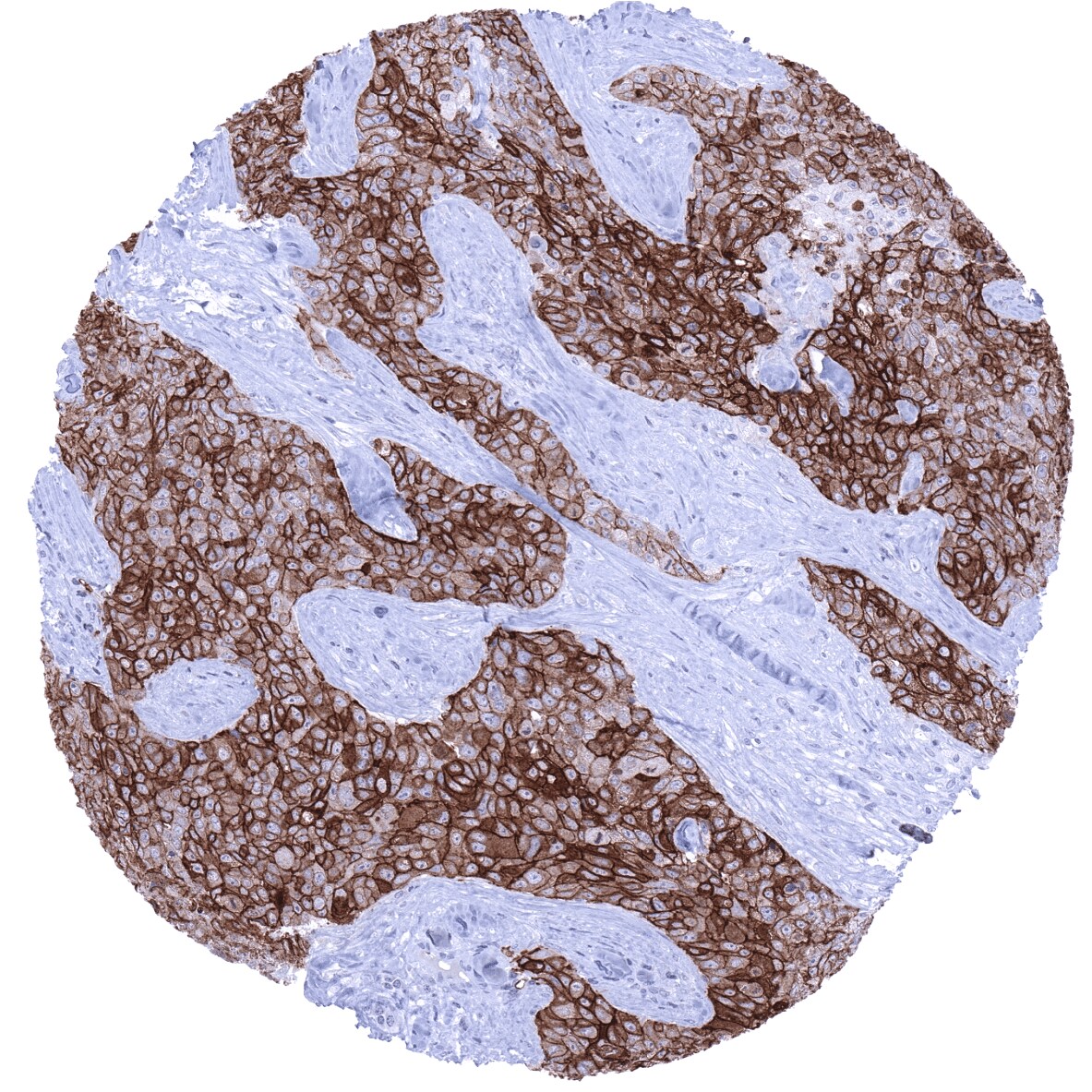 TROP-2 Antibody (MSVA-733R)