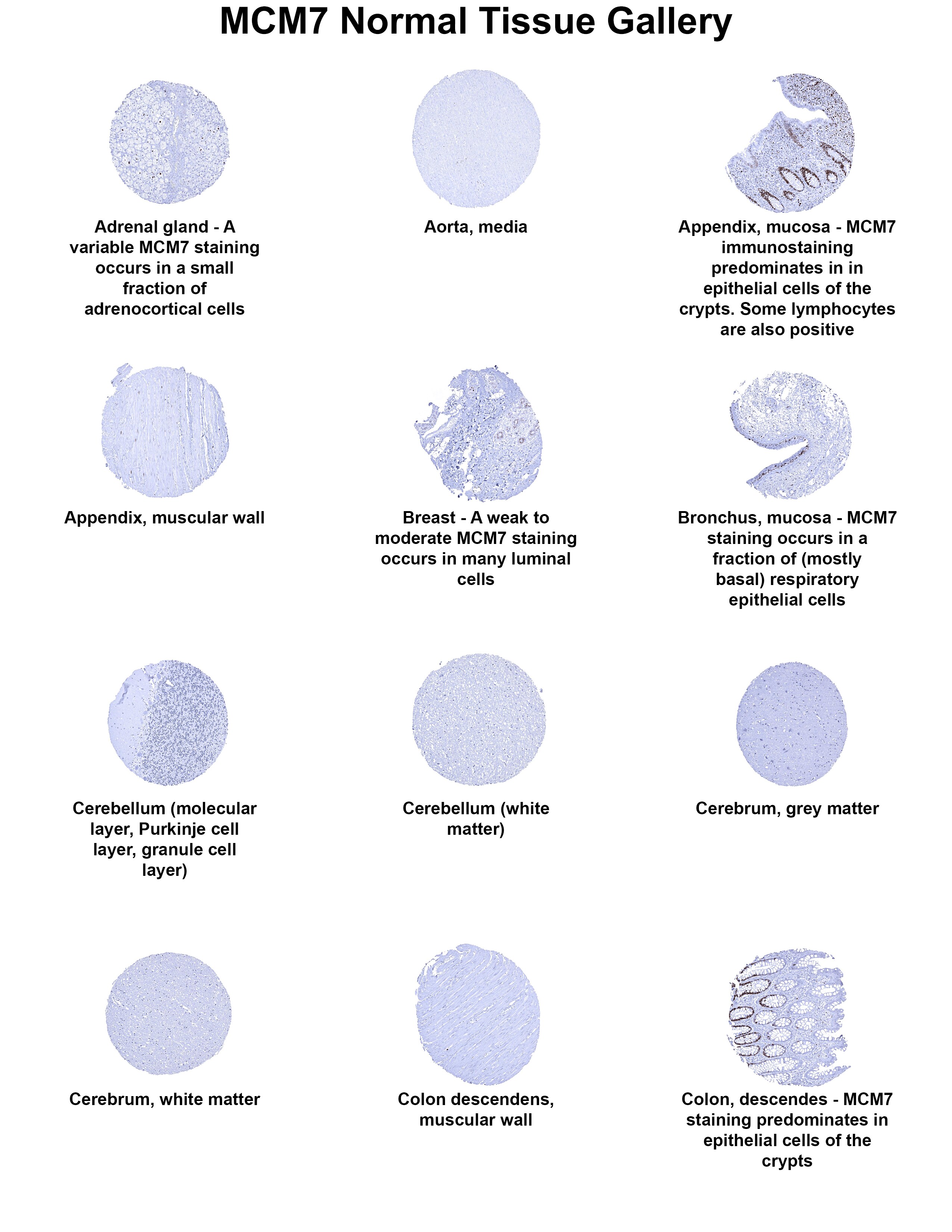 MCM7 Antibody (MSVA-507R) MCM7 Antibody (MSVA-507R) MCM7 Normal Tissue Gallery