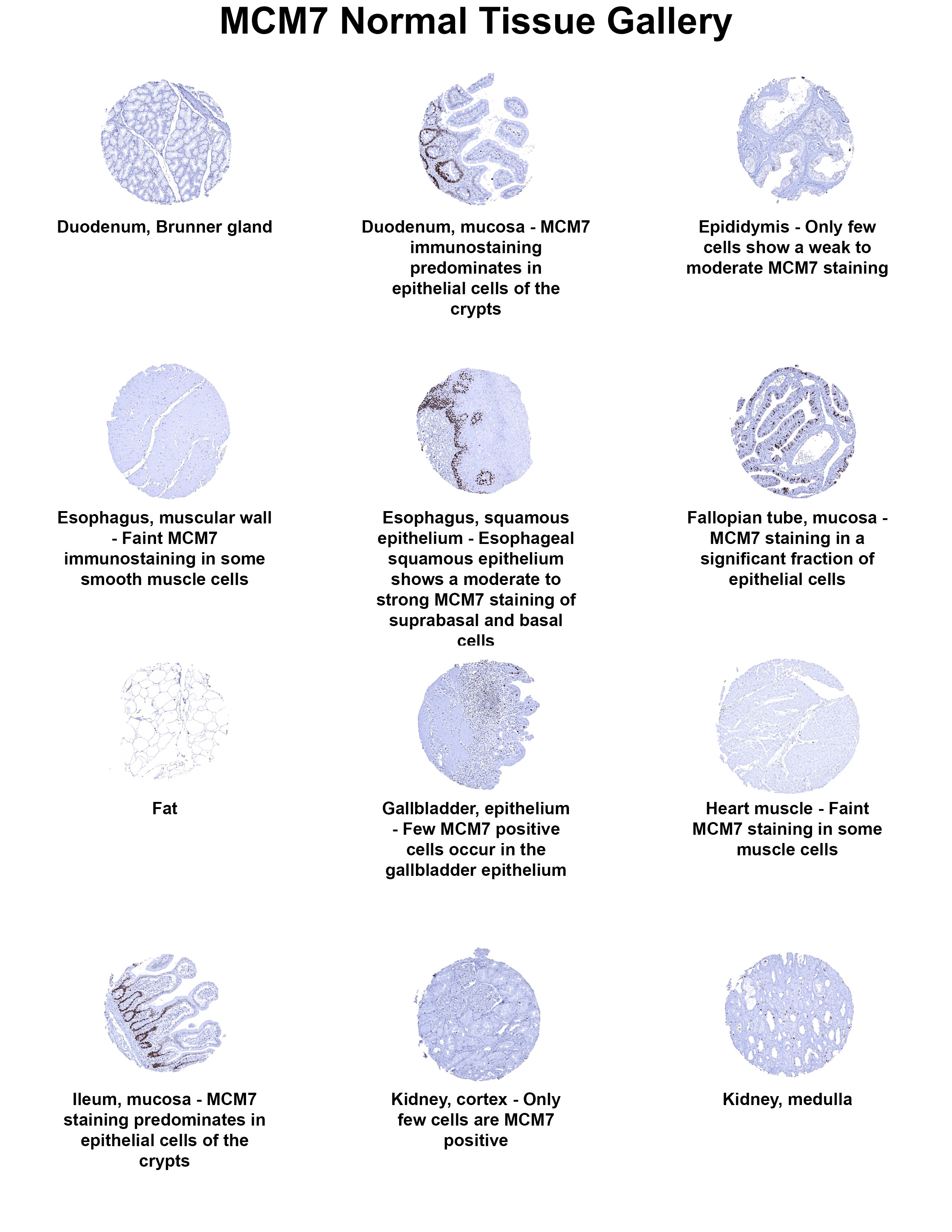 MCM7 Antibody (MSVA-507R) MCM7 Antibody (MSVA-507R) MCM7 Normal Tissue Gallery
