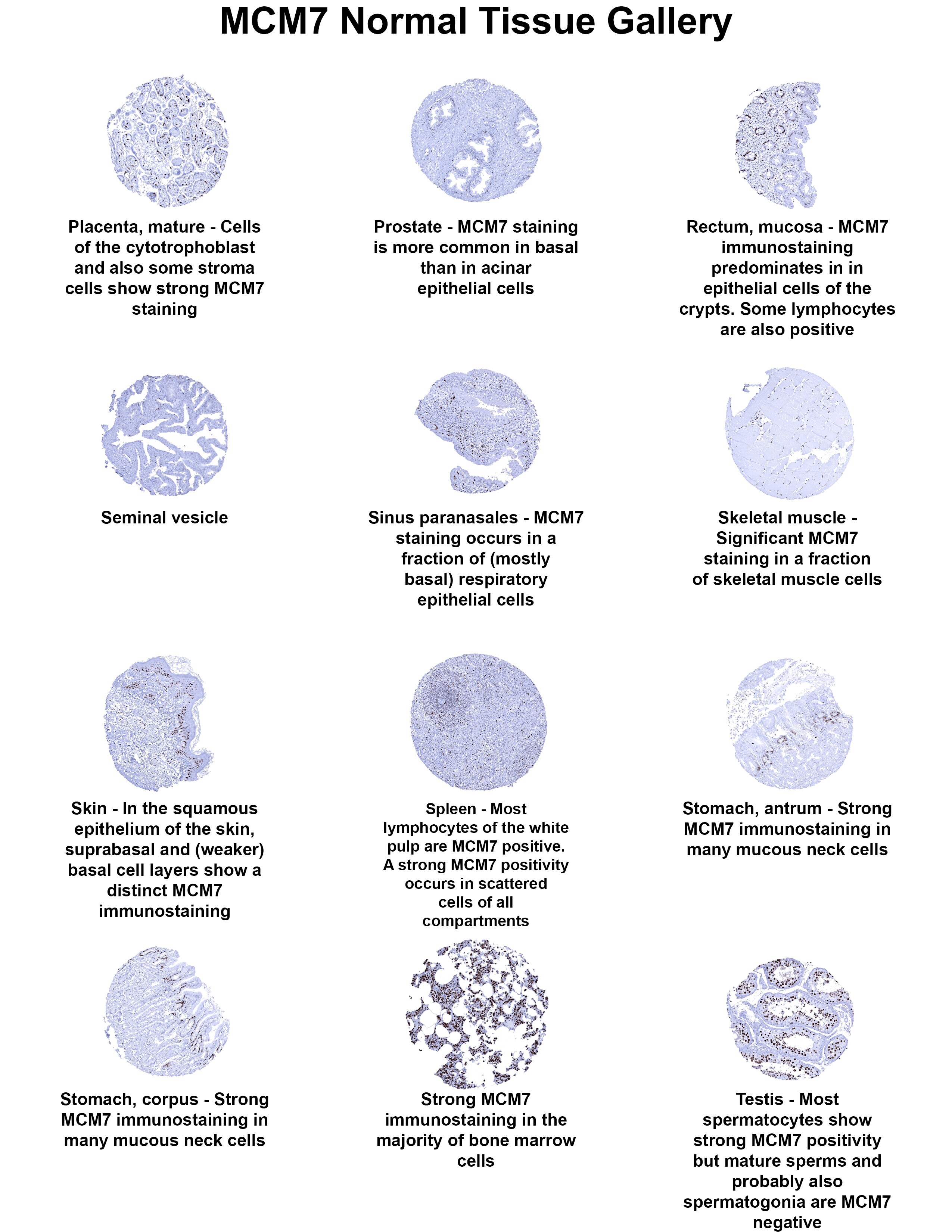 MCM7 Antibody (MSVA-507R) MCM7 Antibody (MSVA-507R) MCM7 Normal Tissue Gallery