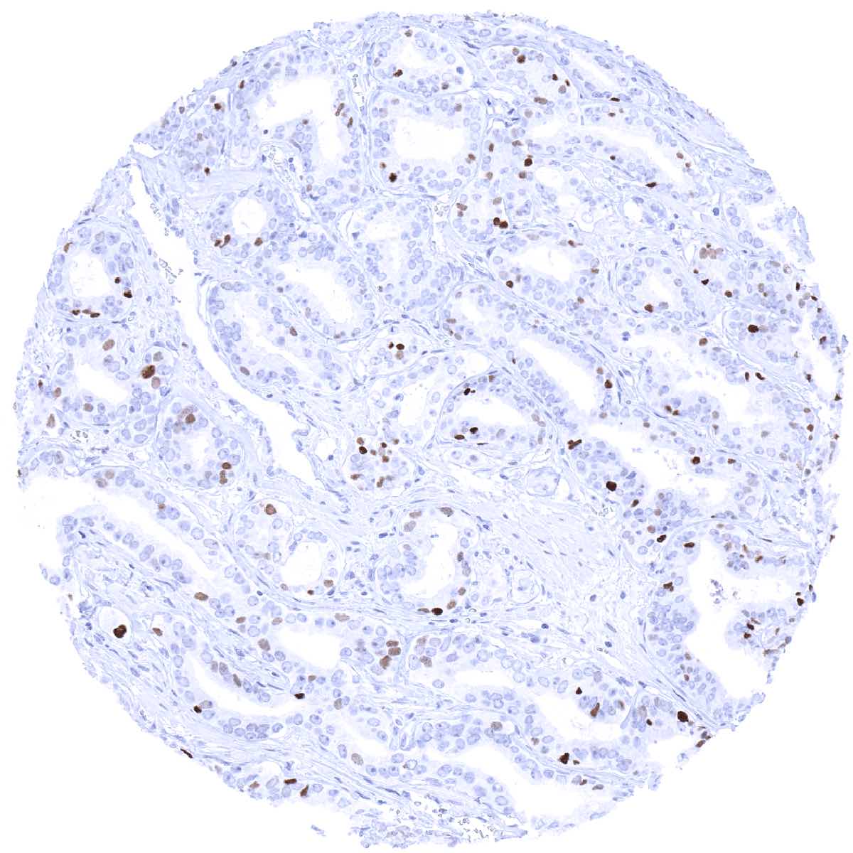 MCM7 Antibody (MSVA-507R)