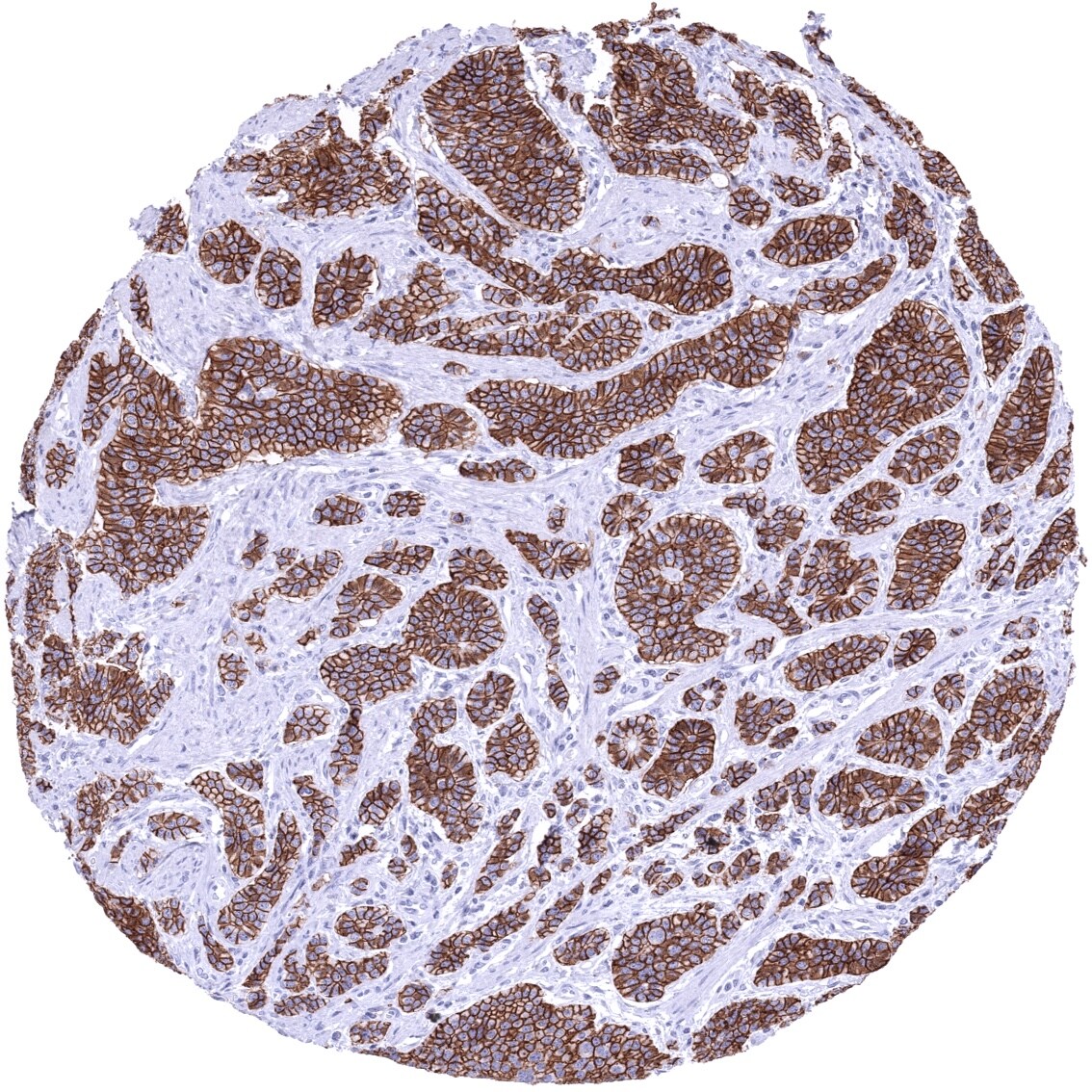 Cadherin-17 Antibody (MSVA-517M)