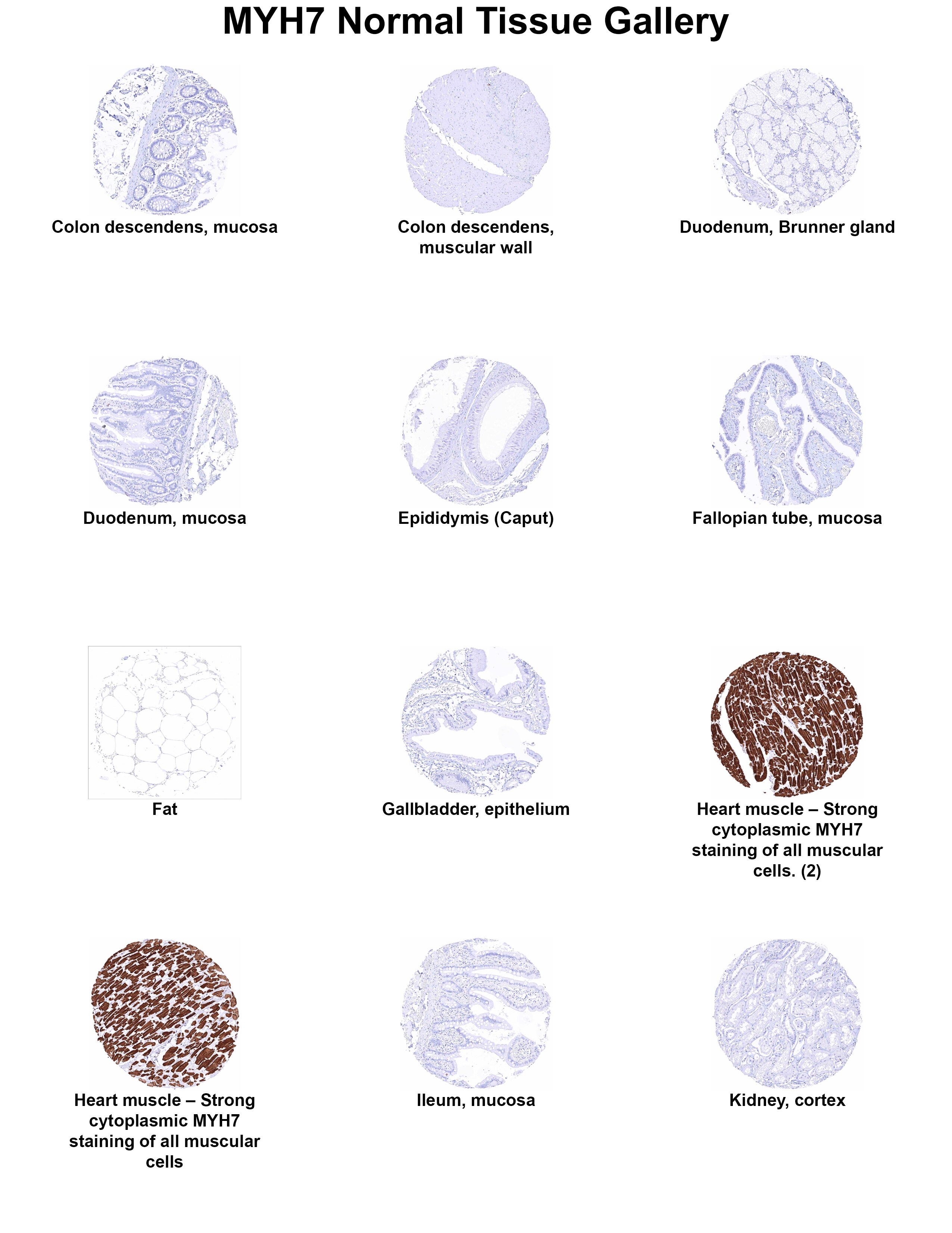 MYH7 Antibody (MSVA-464M) MYH7 Antibody (MSVA-464M) MYH7 Normal Tissue Gallery