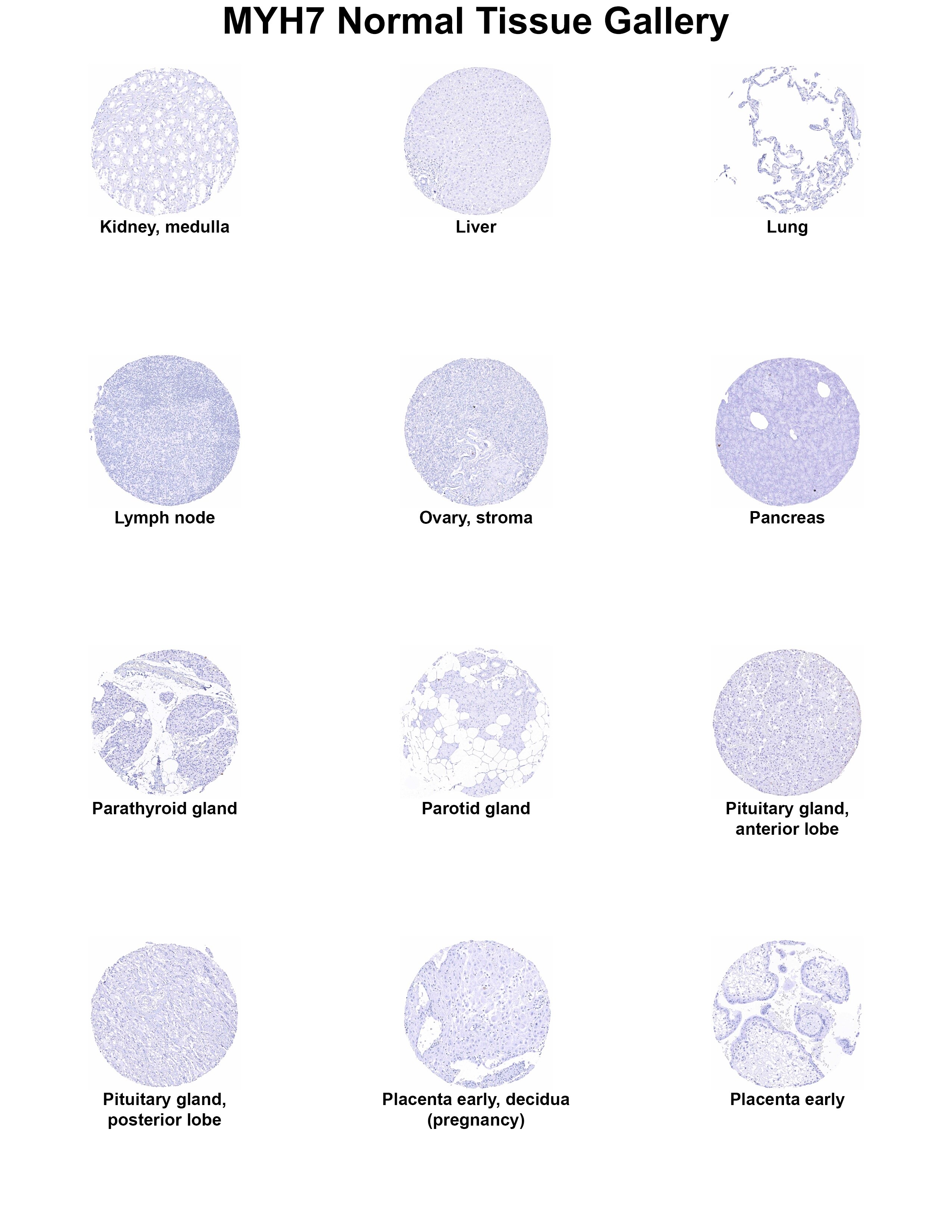 MYH7 Antibody (MSVA-464M) MYH7 Antibody (MSVA-464M) MYH7 Normal Tissue Gallery