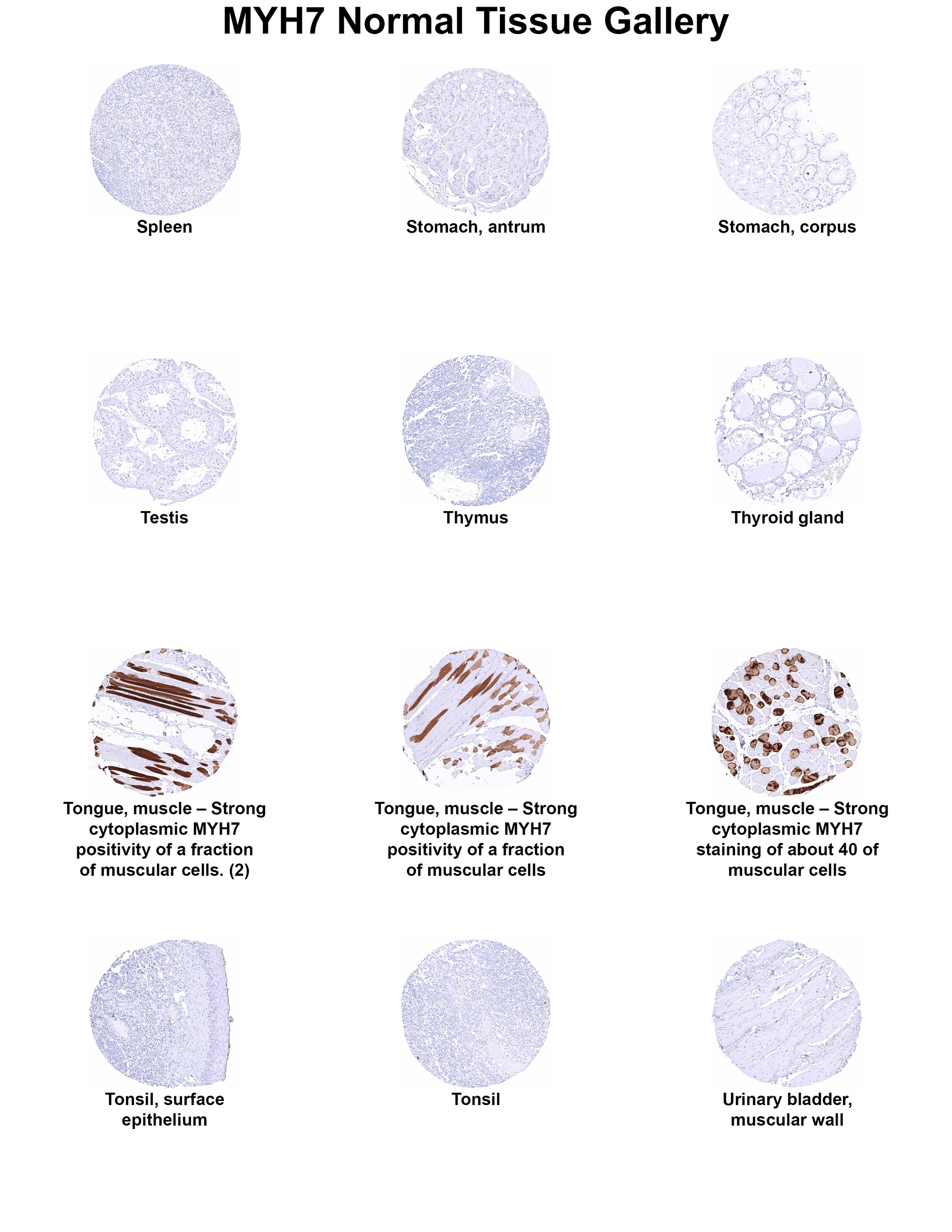 MYH7 Antibody (MSVA-464M) MYH7 Antibody (MSVA-464M) MYH7 Normal Tissue Gallery