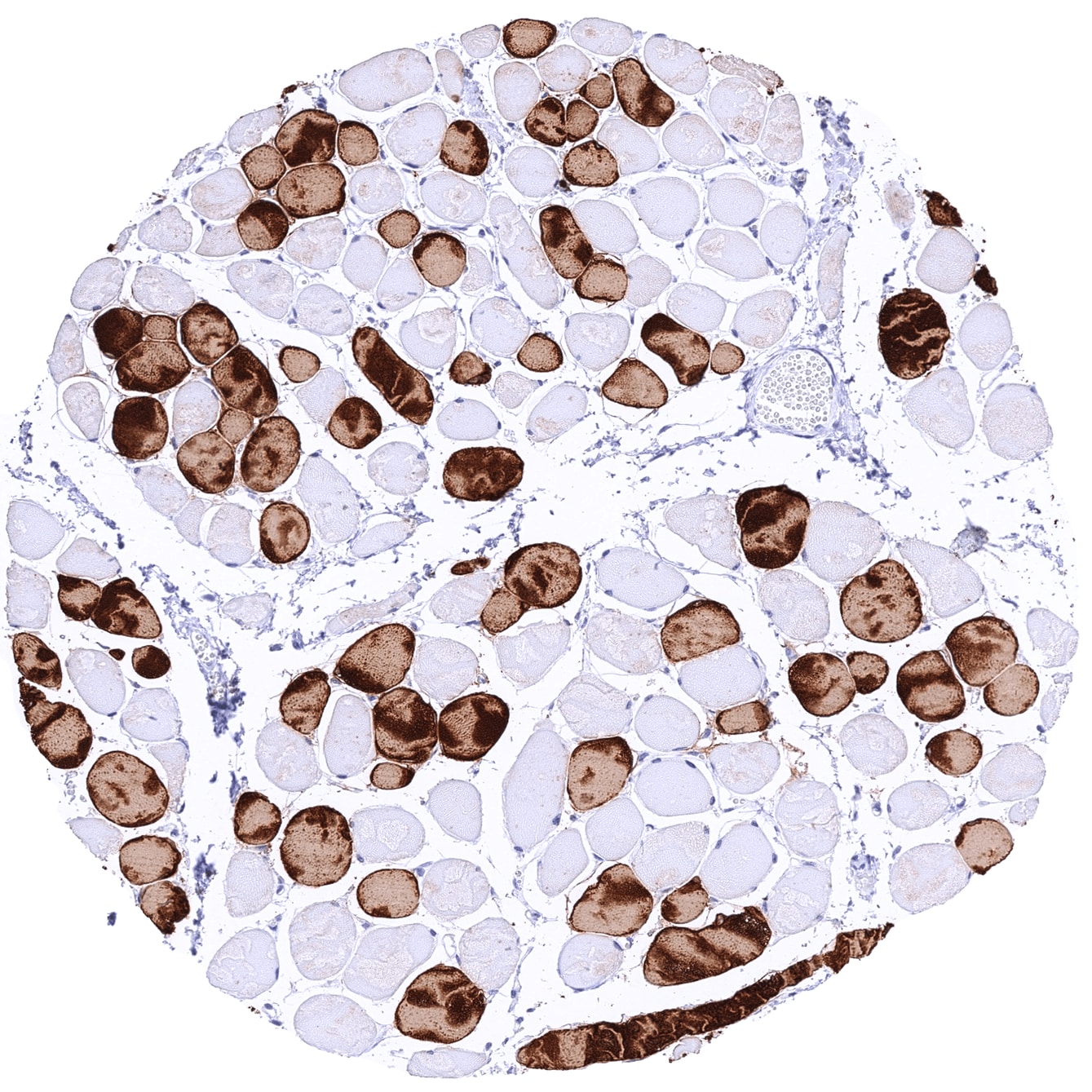 MYH7 Antibody (MSVA-464M)