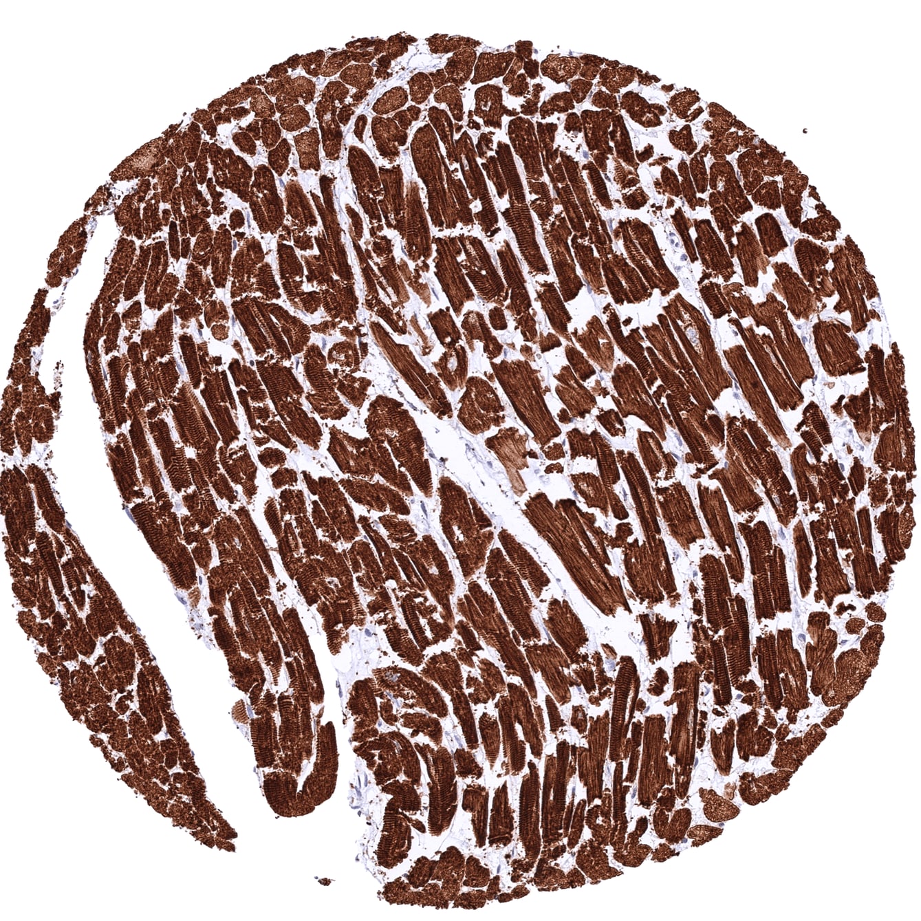 MYH7 Antibody (MSVA-464M)