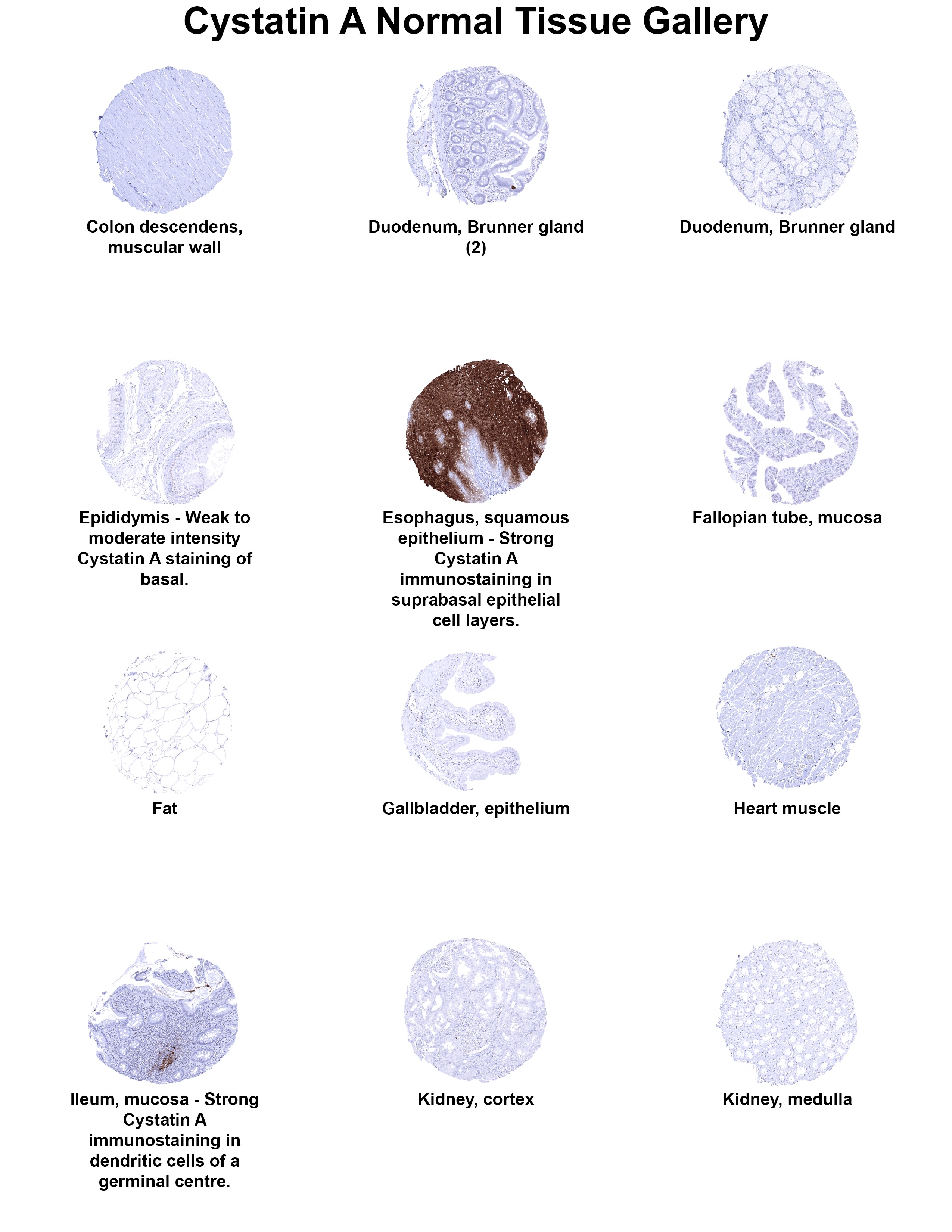 Cystatin A Antibody (MSVA-461M) Cystatin A Antibody (MSVA-461M) Cystatin A Normal Tissue Gallery