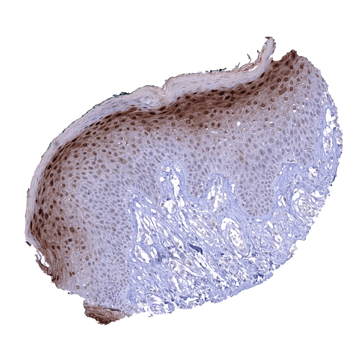 Cystatin A Antibody (MSVA-461M)