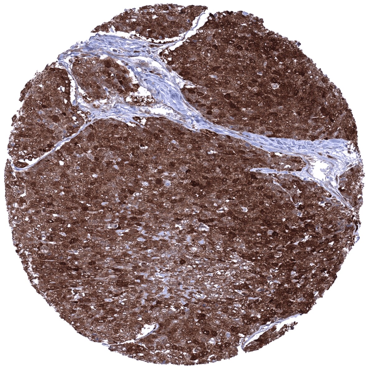 Cystatin A Antibody (MSVA-461M)