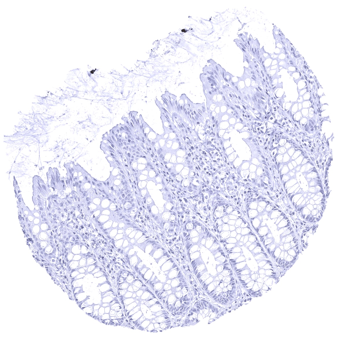 Cystatin A Antibody (MSVA-461M)