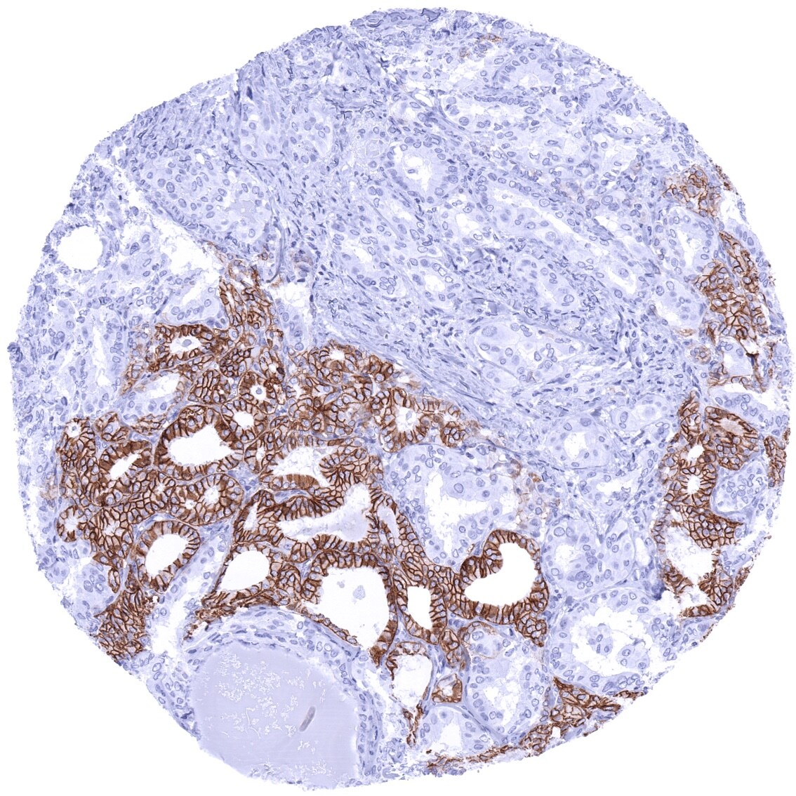 Cadherin-16 Antibody (MSVA-516R)