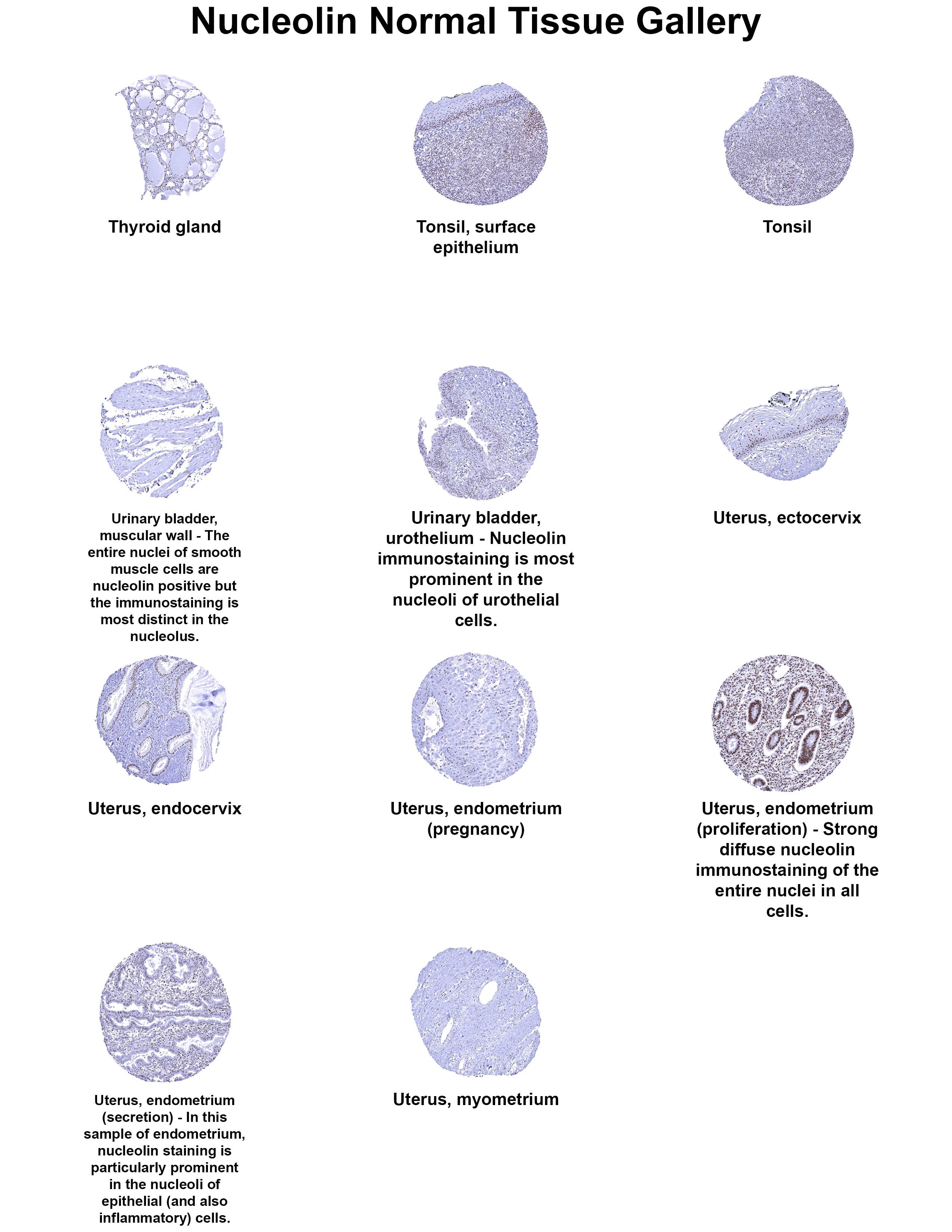 Nucleolin Antibody (MSVA-623R) Nucleolin Antibody (MSVA-623R) Nucleolin Normal Tissue Gallery